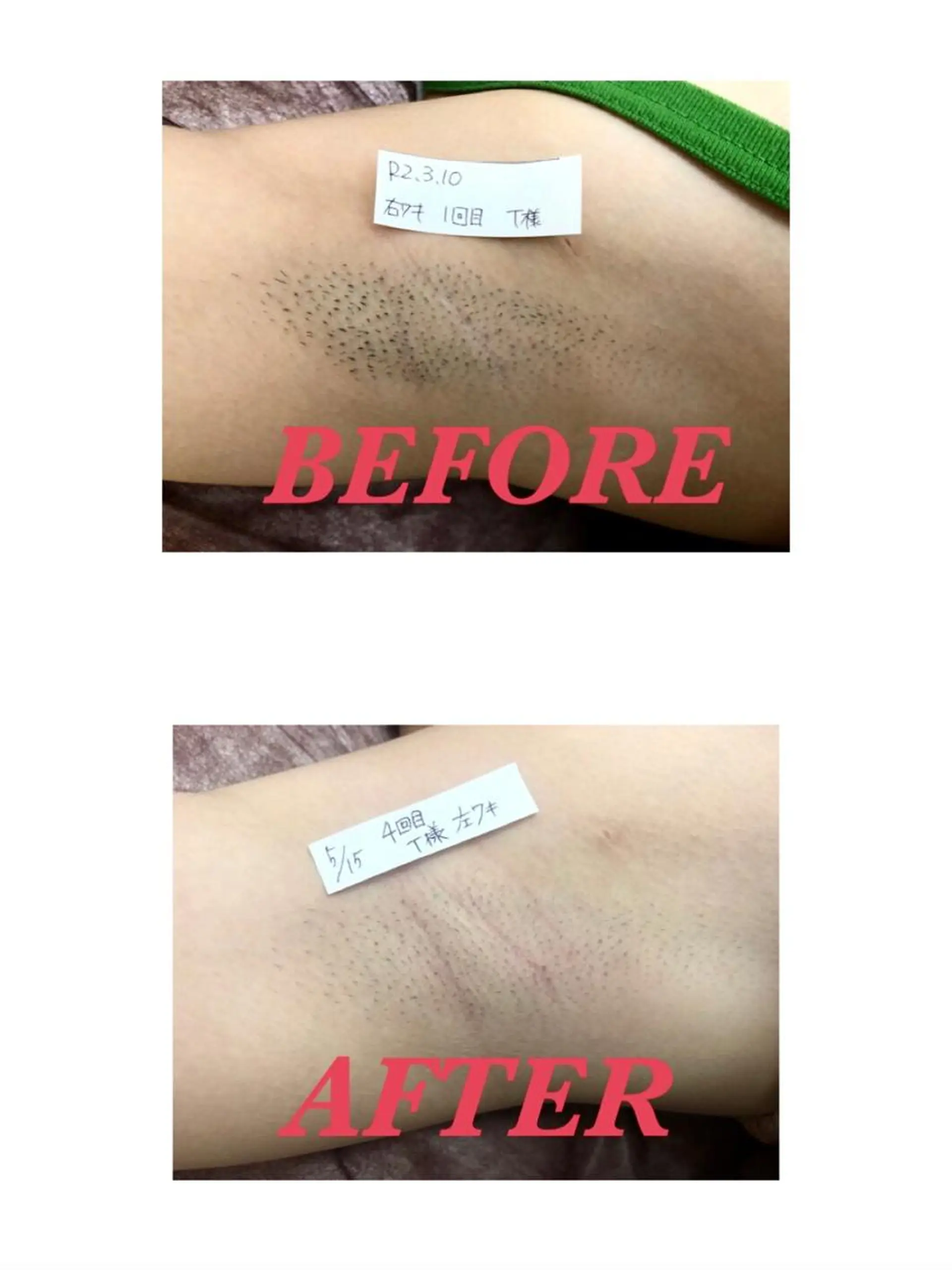 脱毛 Prima 痩身脱毛 にごうかおりのエステ・リラクイメージ