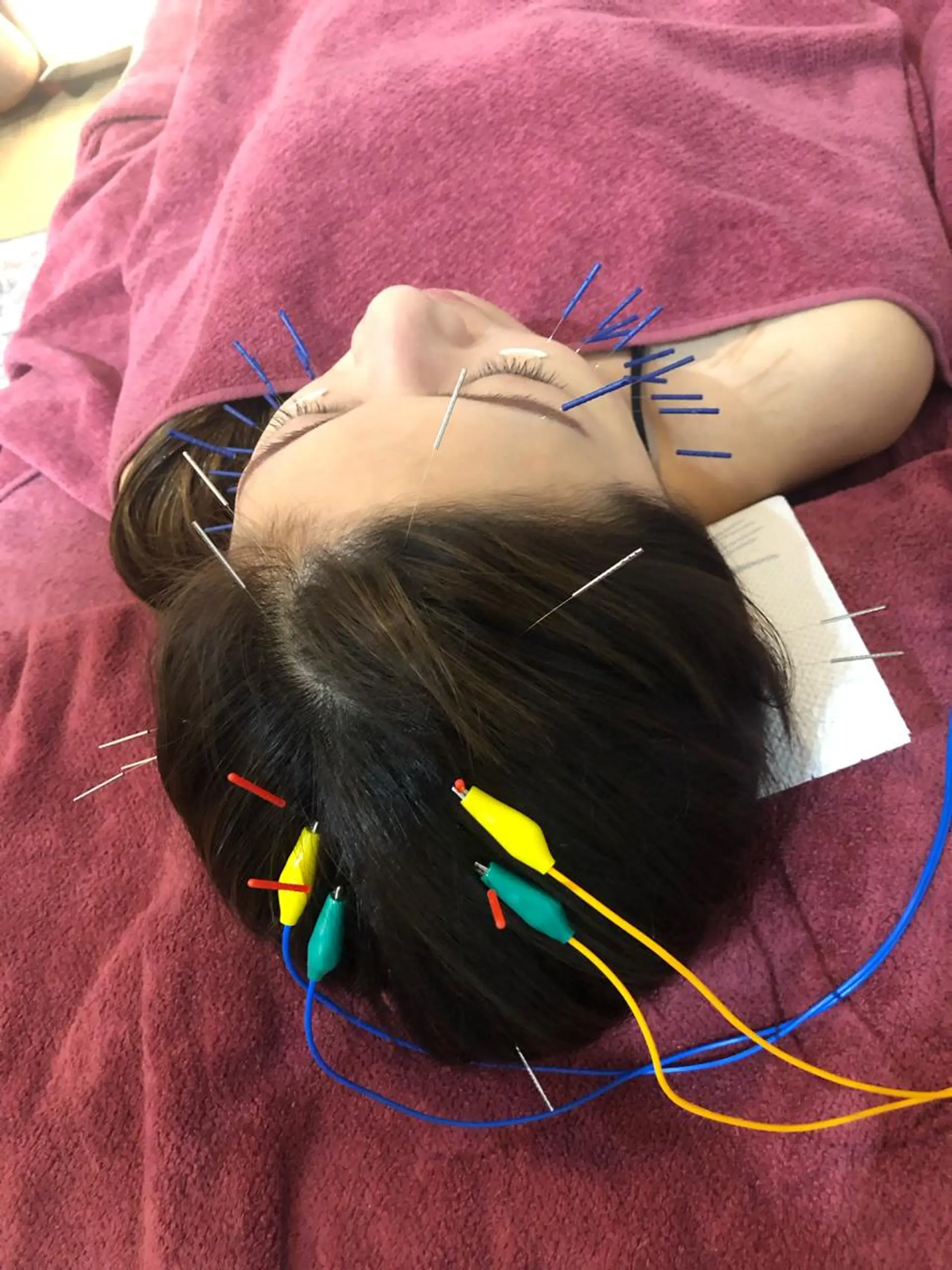 エステ リラク 美容鍼灸女性専用 りんご鍼灸治療院のその他イメージ