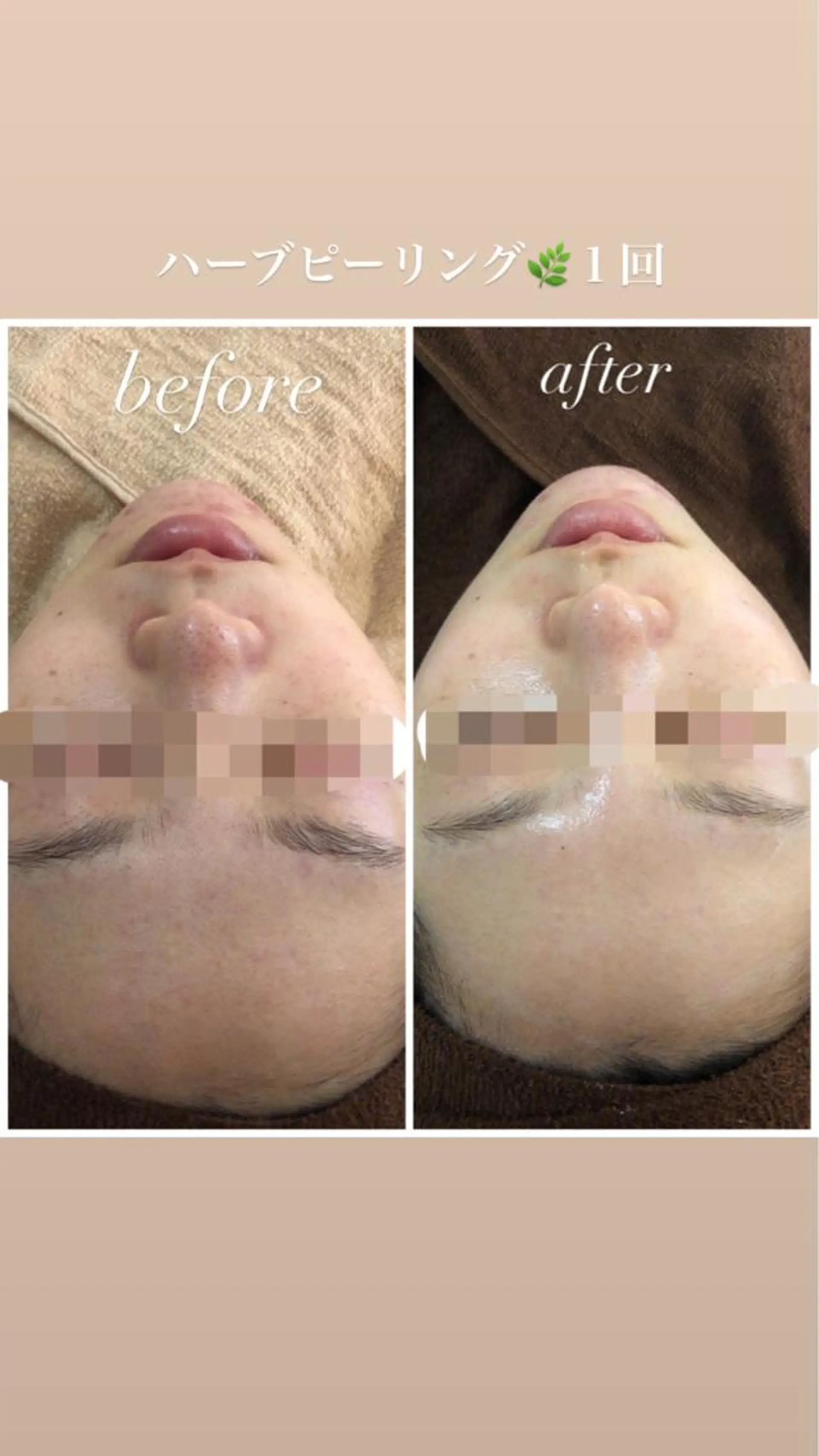 セミロング カラー パーマ ヘアアレンジ メンズ キッズ ネイル マツエク・マツパ Amaryllis 🌹のエステ・リラクイメージ