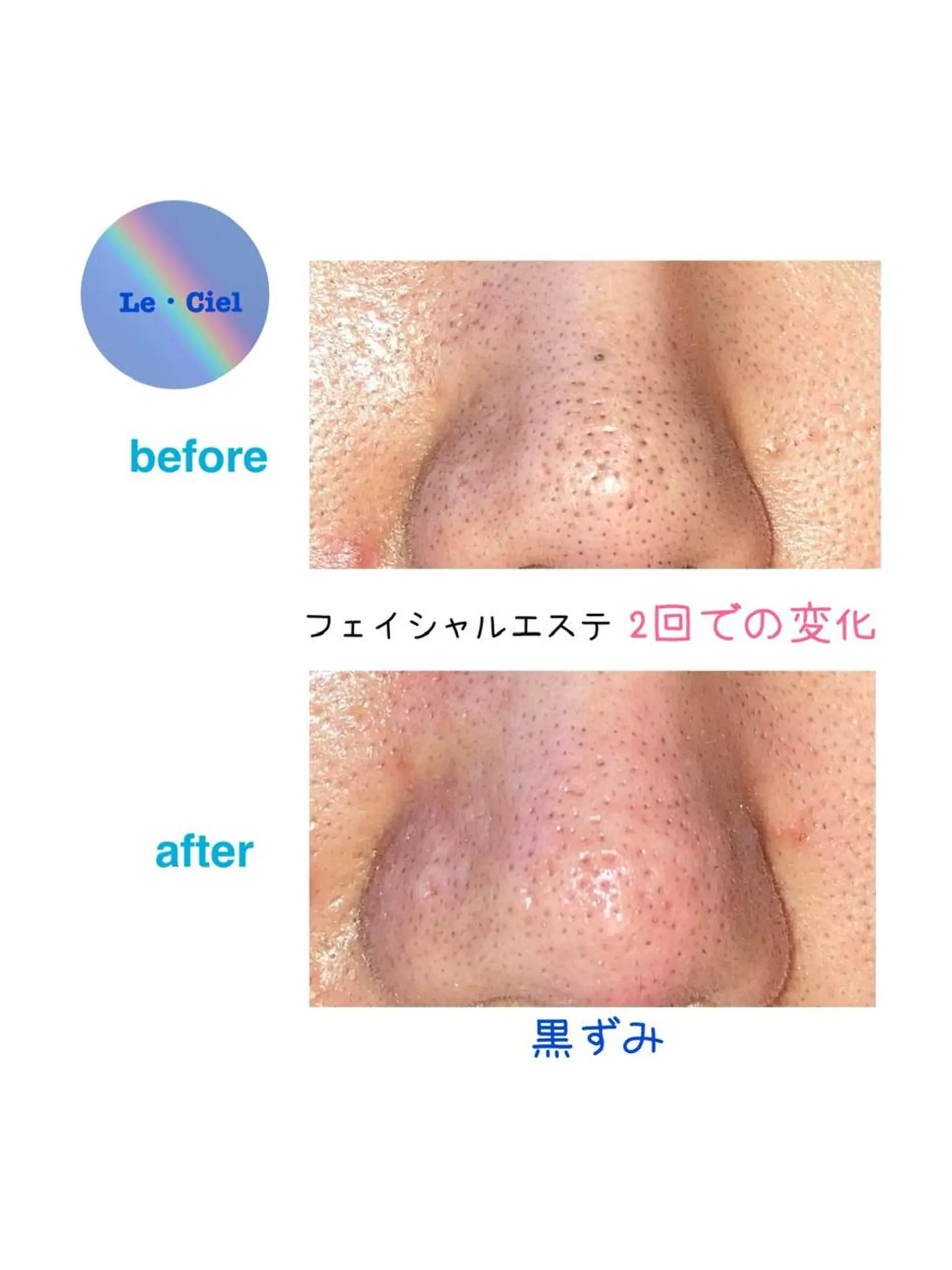 Le・Ciel フェイシャル&ボディのエステ・リラクイメージ