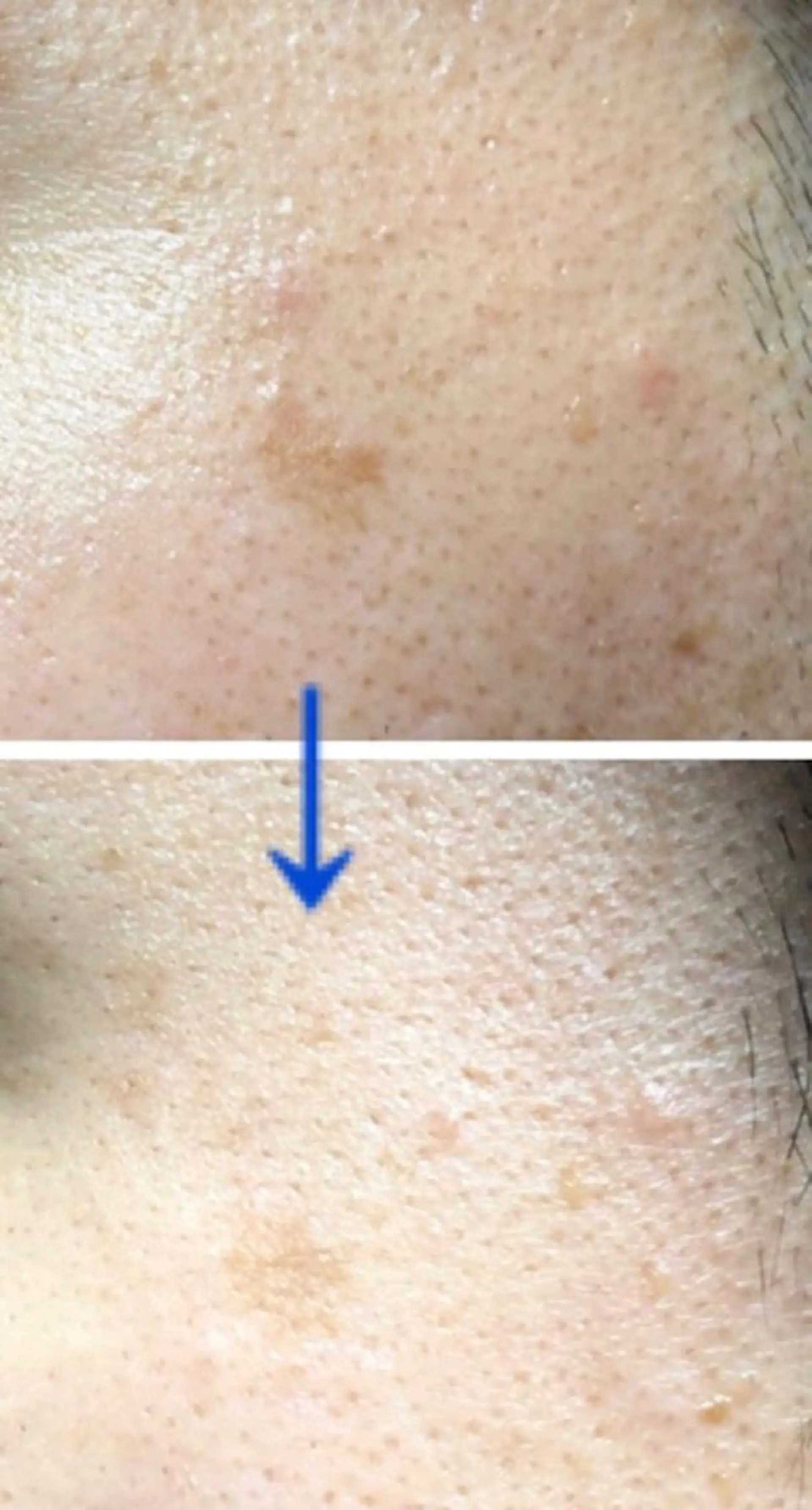 朝重い人専用 肩甲骨調整のエステ・リラクイメージ