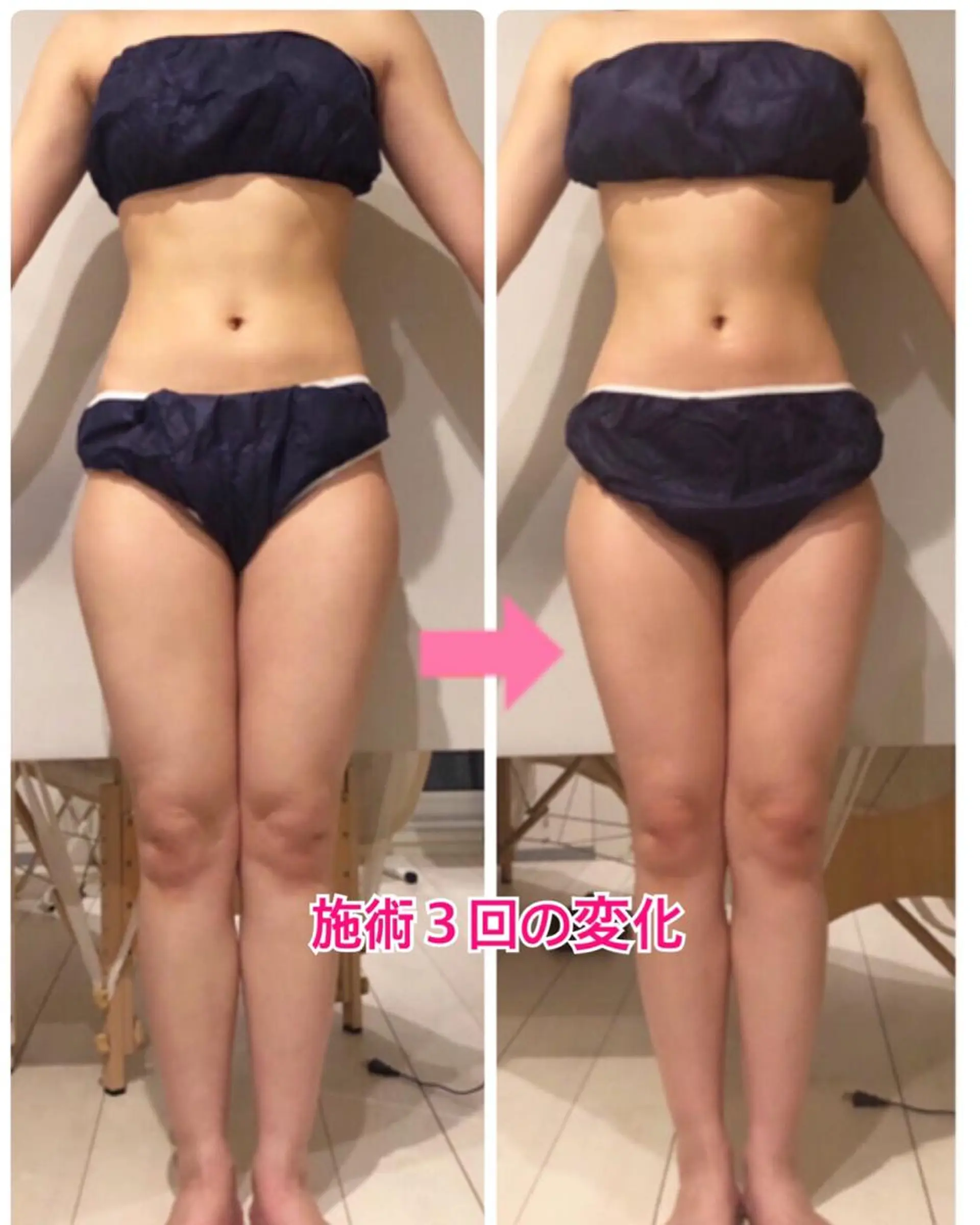 ロング カラー パーマ ヘアアレンジ メンズ キッズ ネイル マツエク・マツパ マットネイル 痩身&ボディ 結果出し🌟丹野のエステ・リラクイメージ