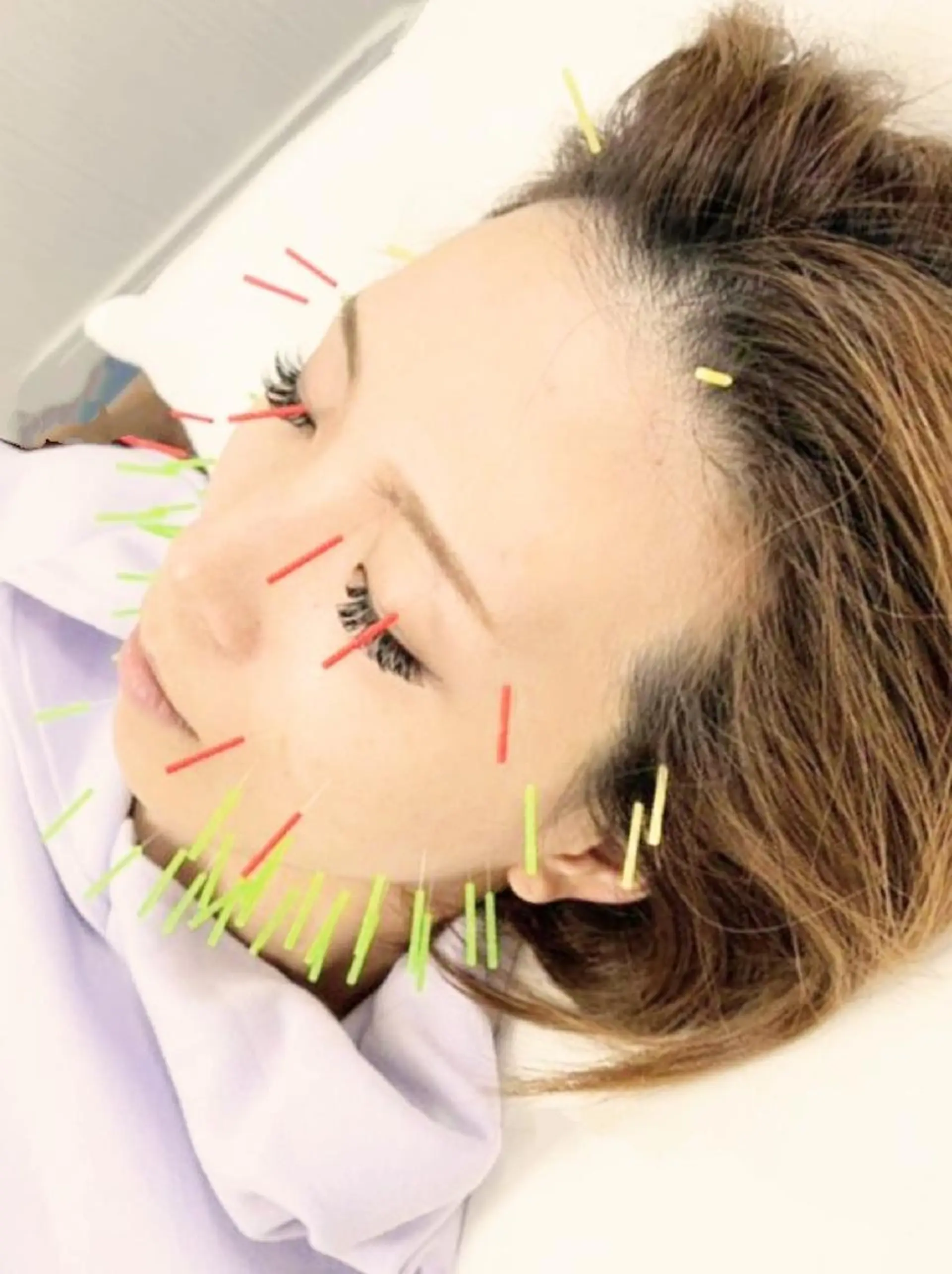 サポート 鍼灸整骨院のエステ・リラクイメージ