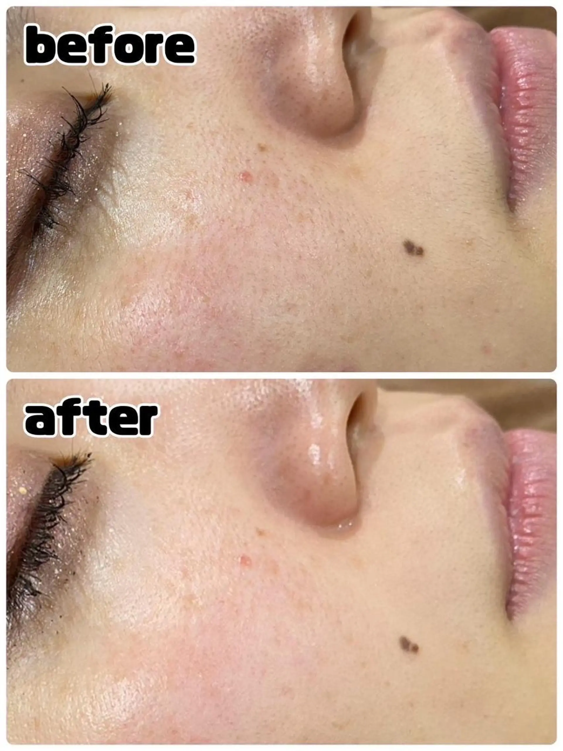 エステ レイビス 渋谷店中野🤍のエステ・リラクイメージ