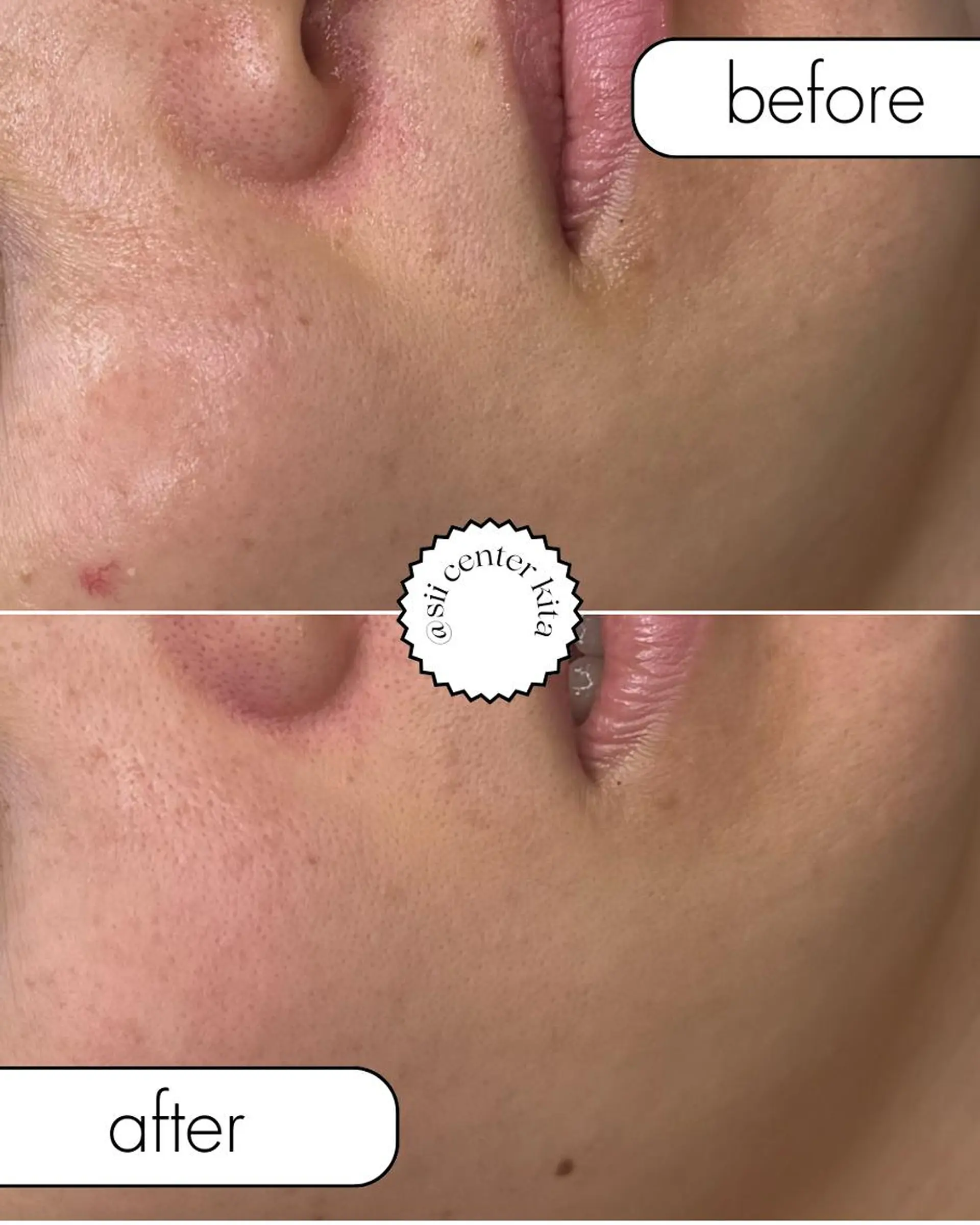 OAK×NACHUL 成城学園前のエステ・リラクイメージ