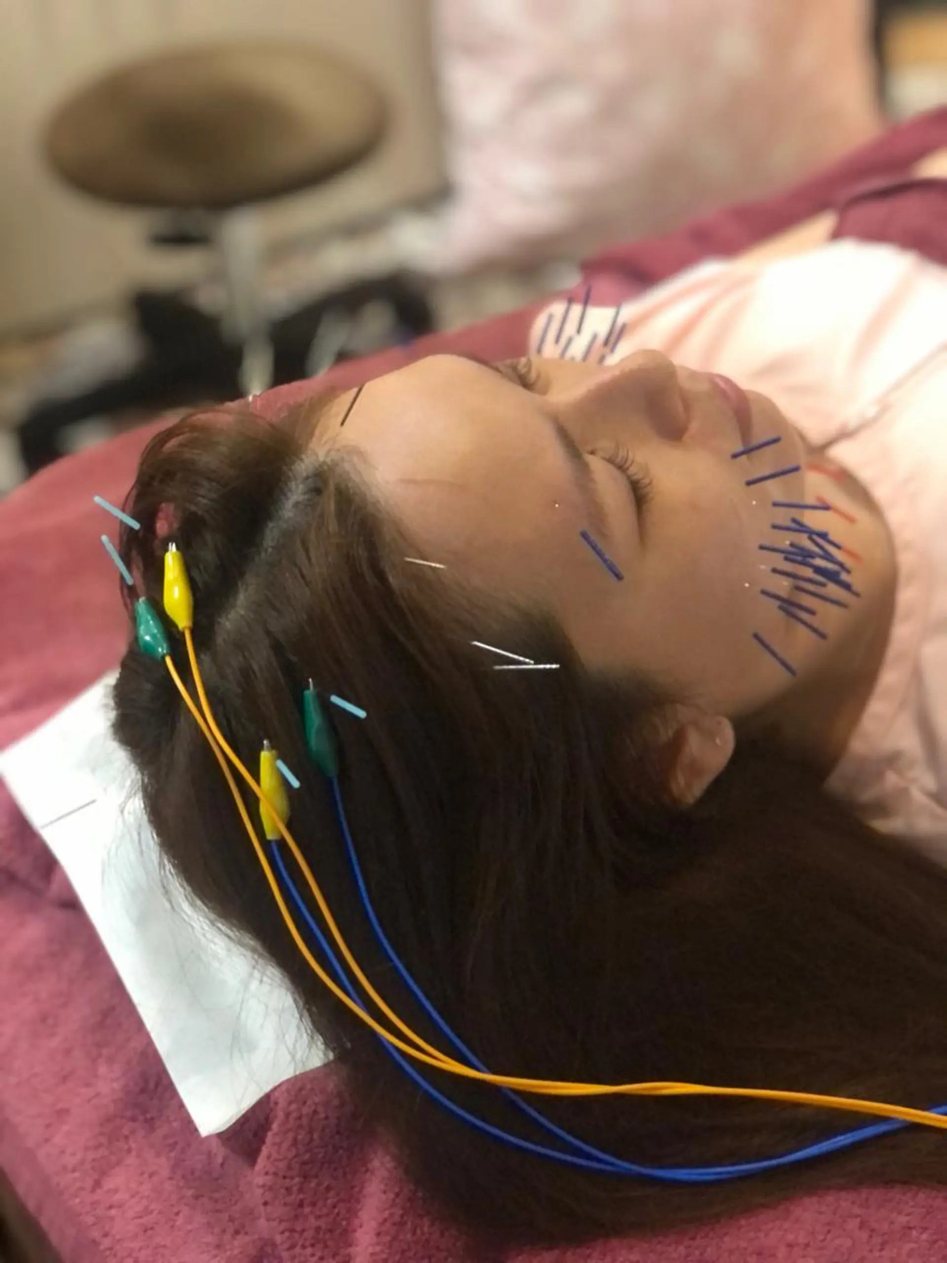 エステ リラク 美容鍼灸女性専用 りんご鍼灸治療院のその他イメージ