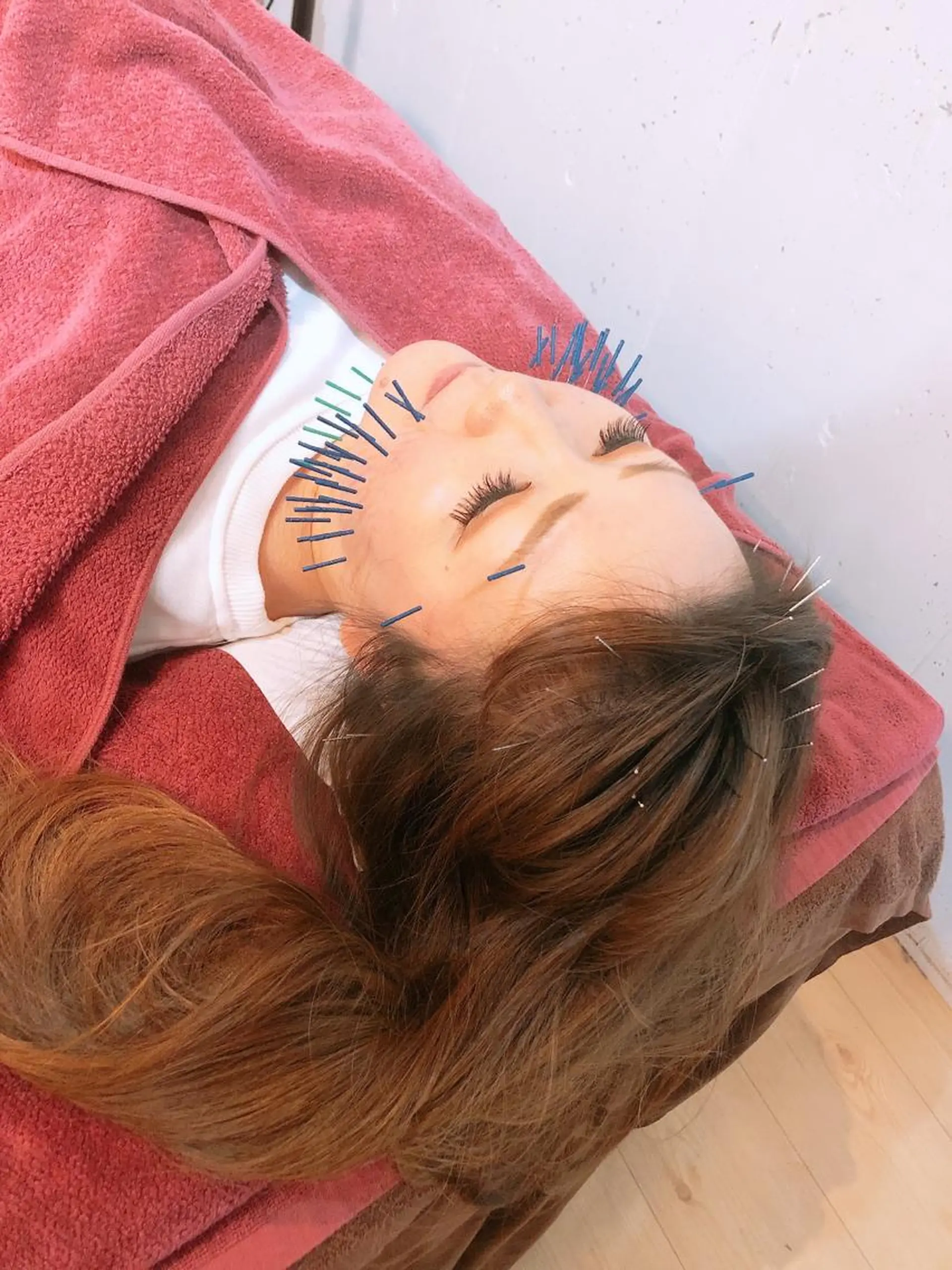 エステ リラク 美容鍼灸女性専用 りんご鍼灸治療院のその他イメージ