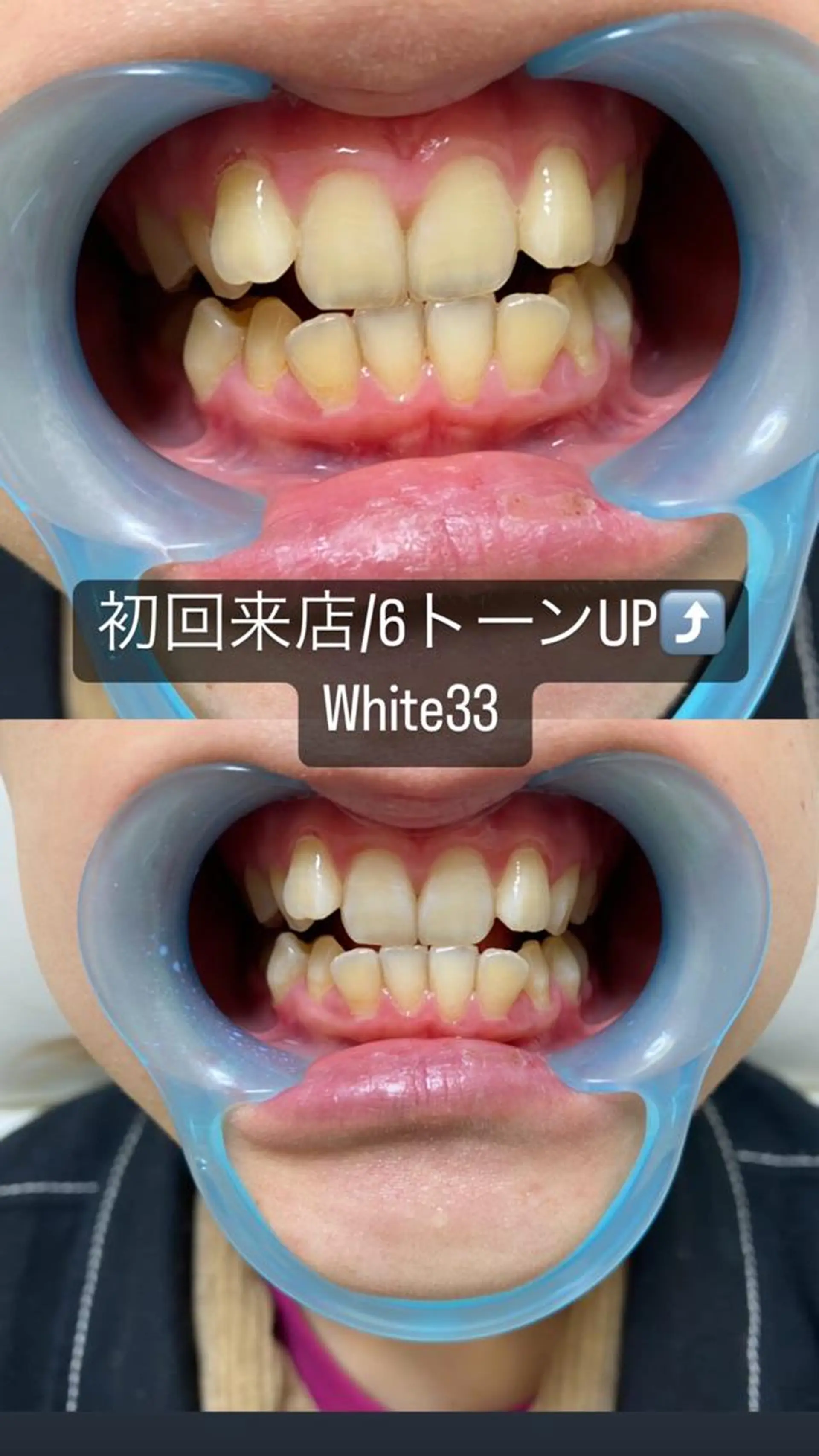 メンズ セルフホワイトニング White33大名のその他イメージ