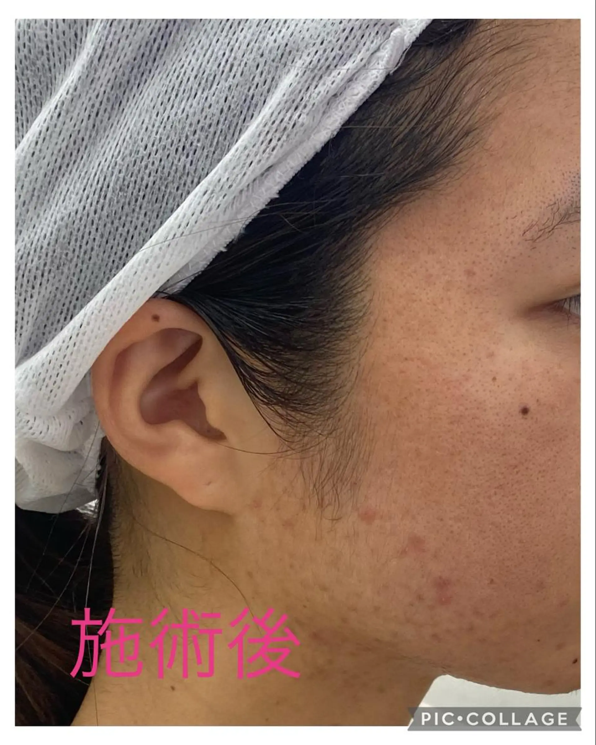 エステ ノエビア ラボーテサロンのエステ・リラクイメージ