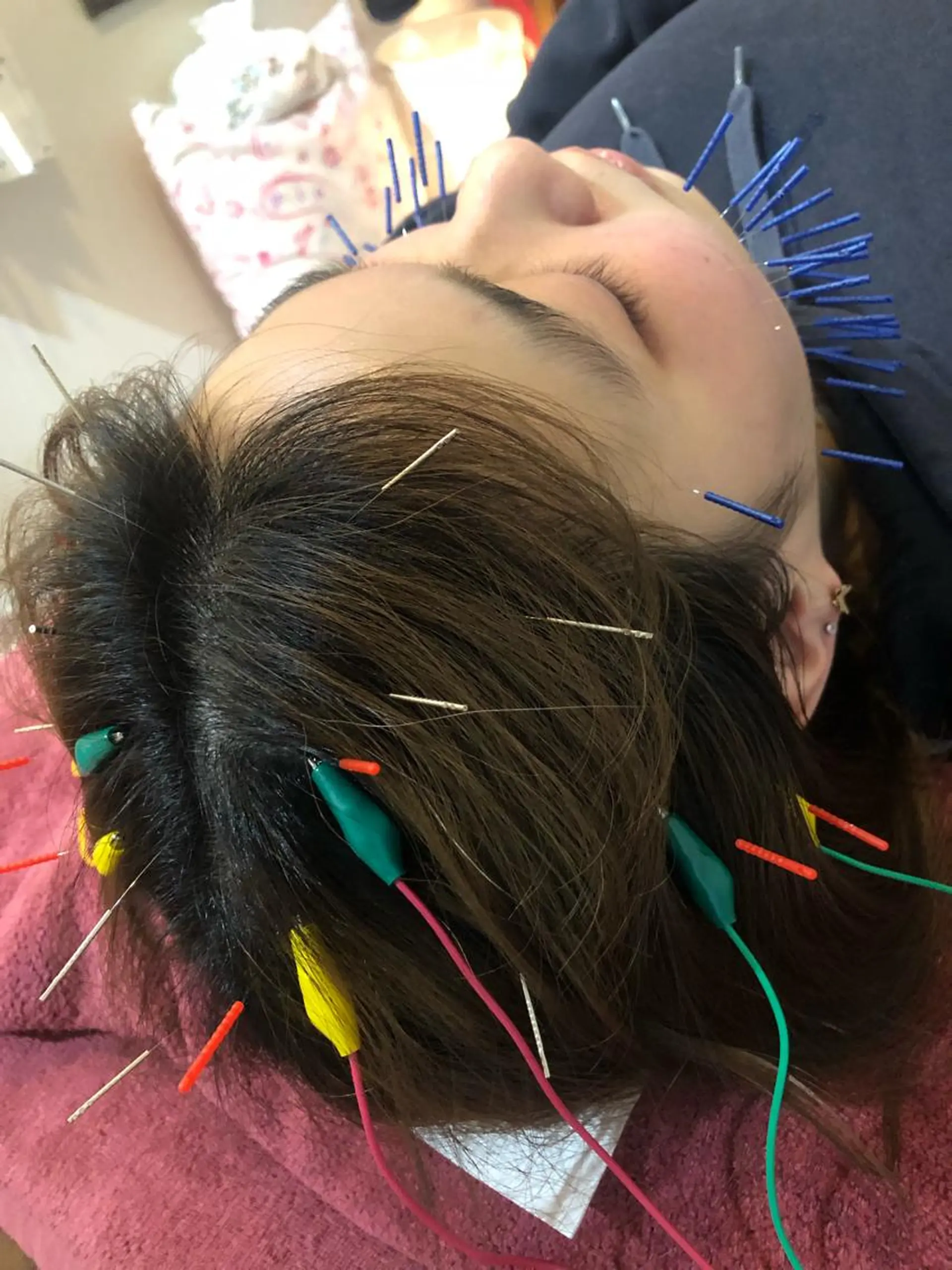 エステ リラク 美容鍼灸女性専用 りんご鍼灸治療院のその他イメージ