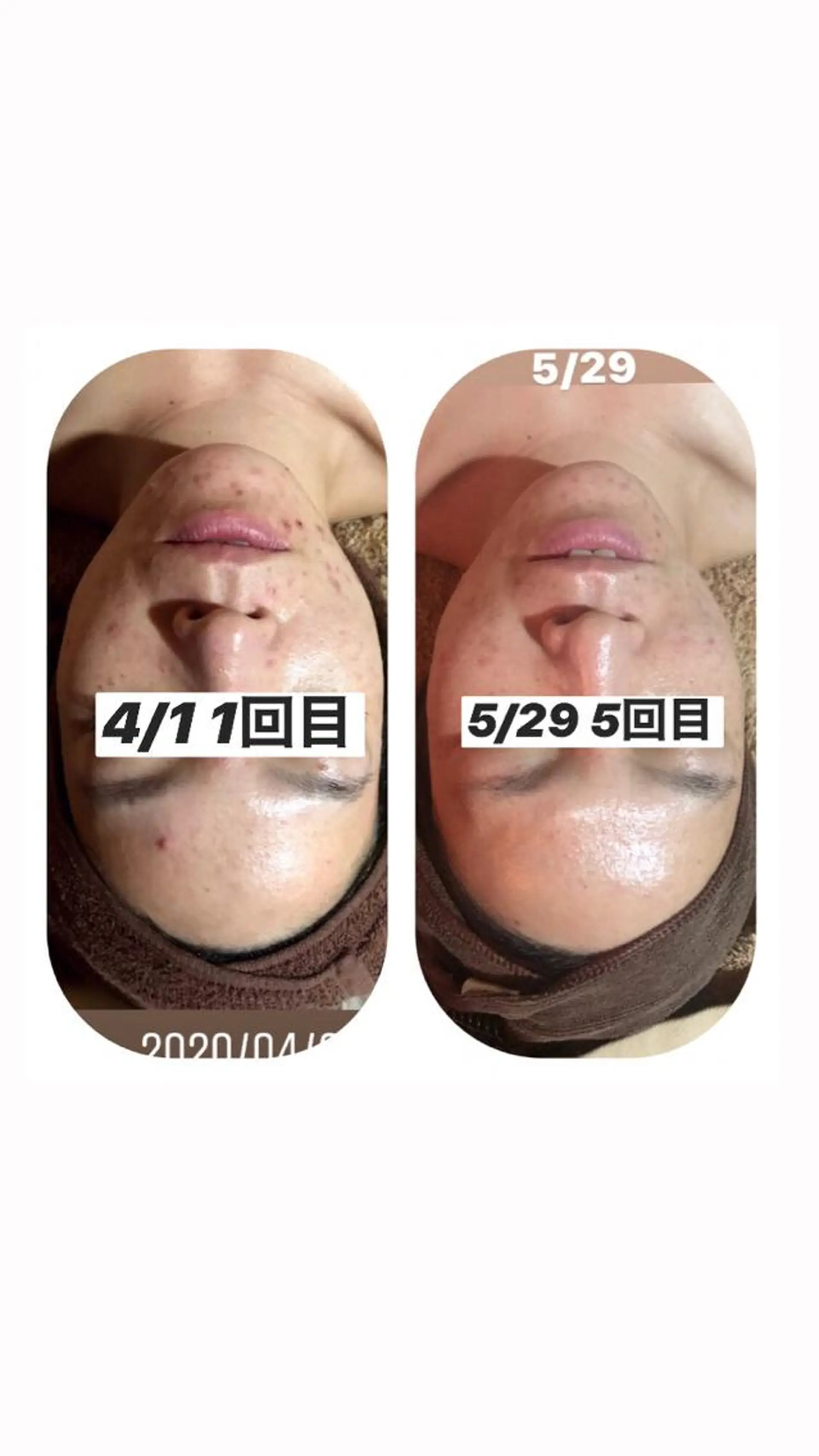 エステ 【足圧】鬼👹リンパ 身体整うサロンのエステ・リラクイメージ