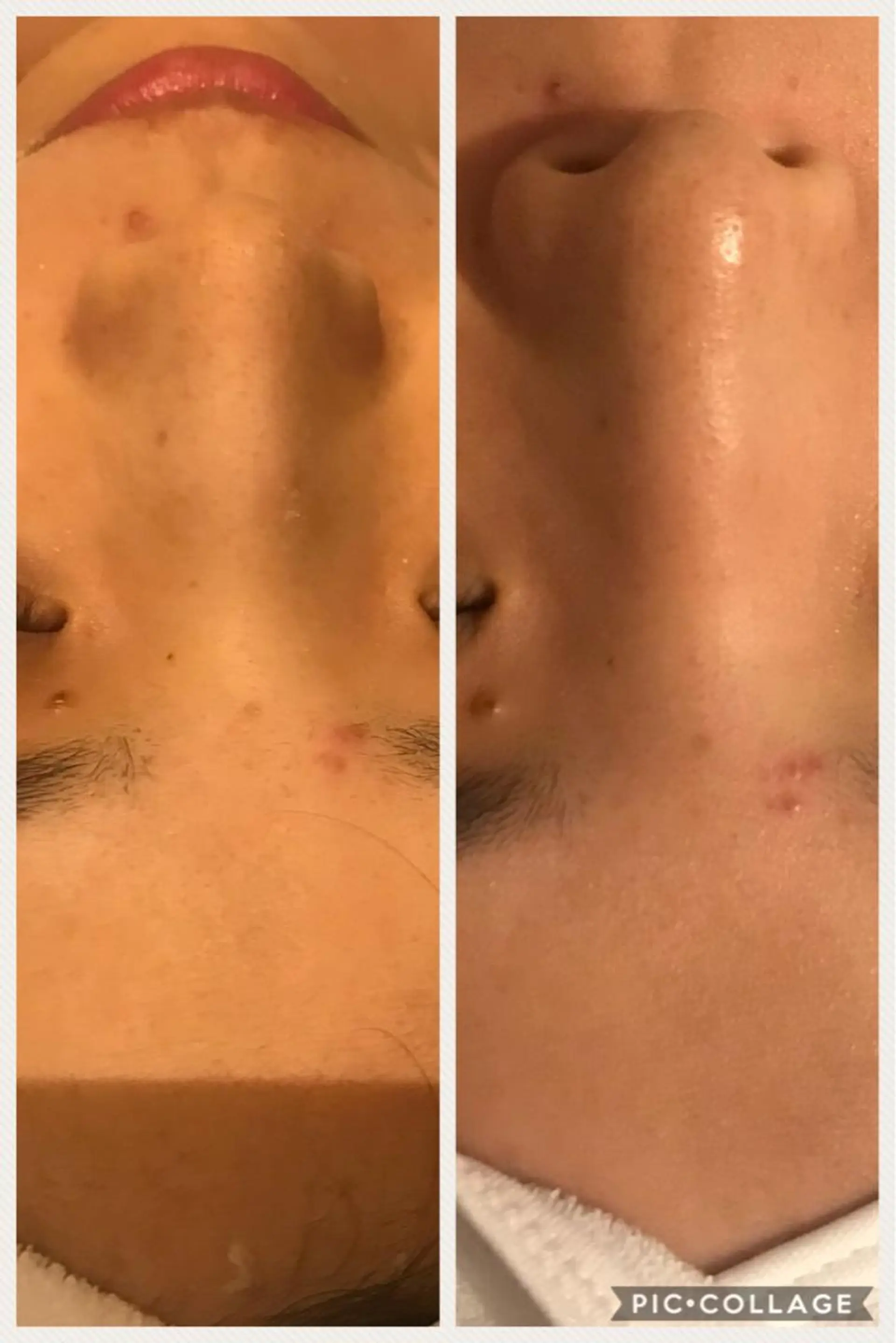 メンズ 金の糸脱毛 産毛ケア専門のエステ・リラクイメージ