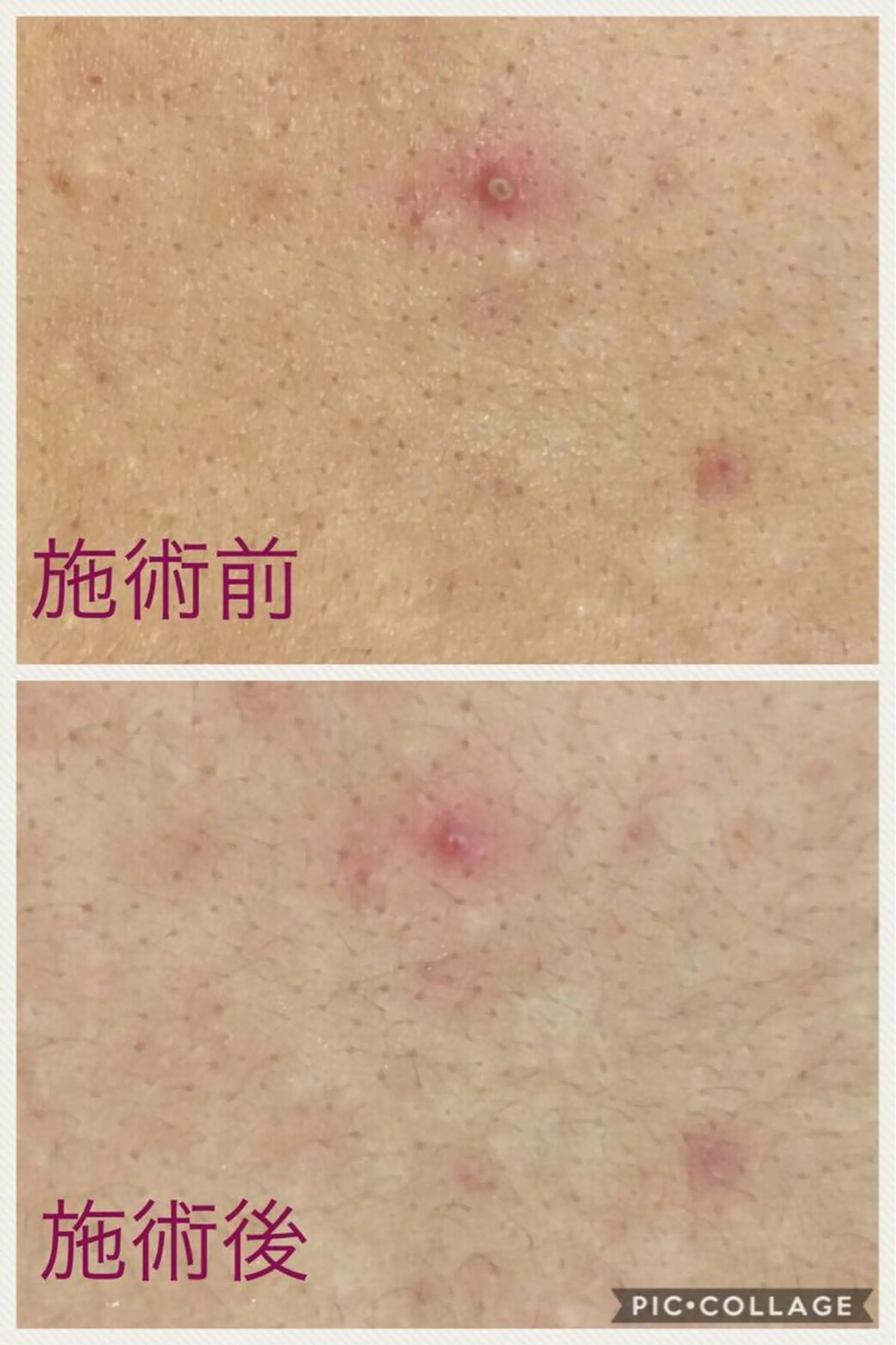 ニキビ・肌質改善専門 ♡人生が変わるサロンのエステ・リラクイメージ