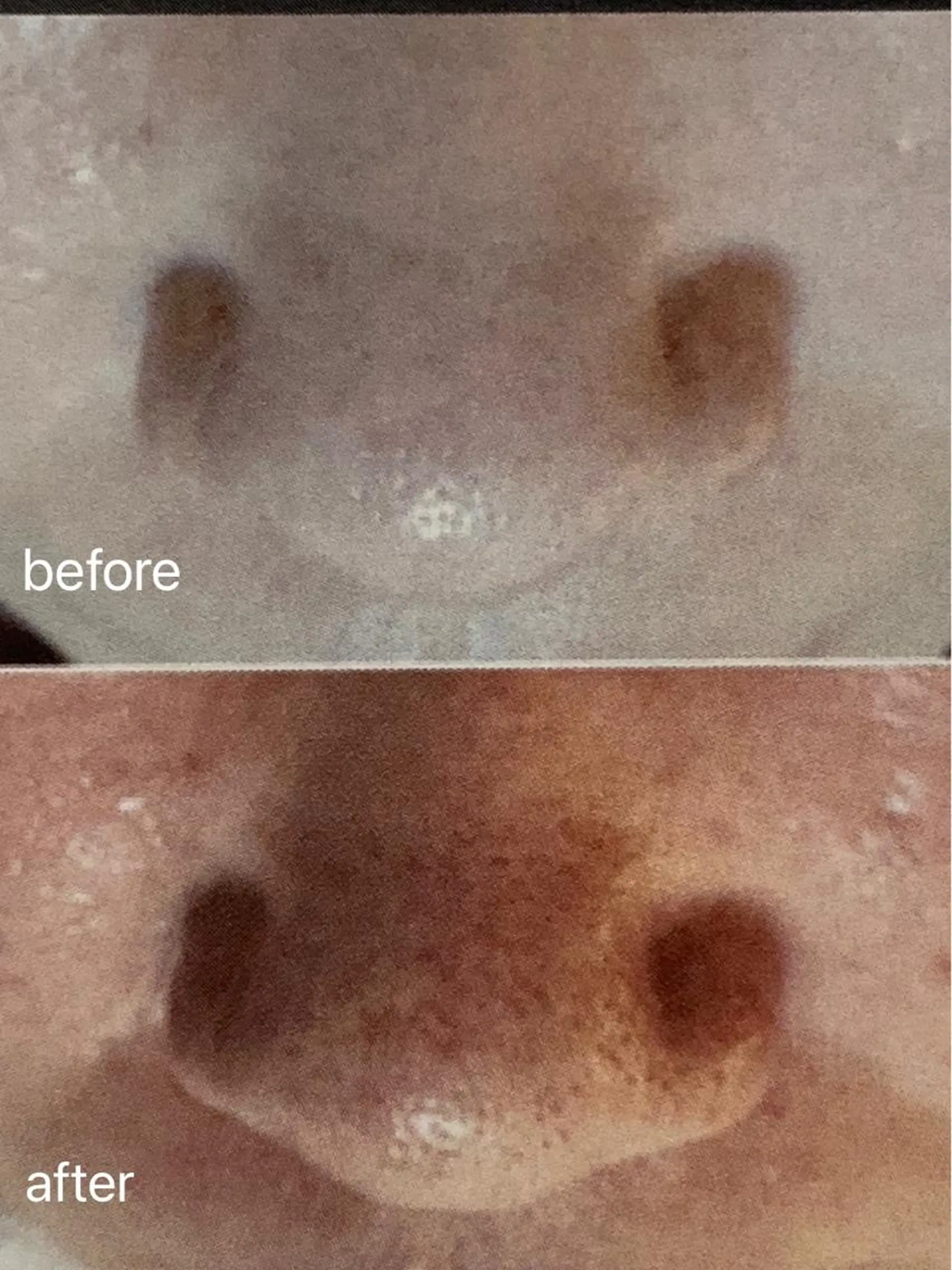 エステ M.rose エムローズのエステ・リラクイメージ