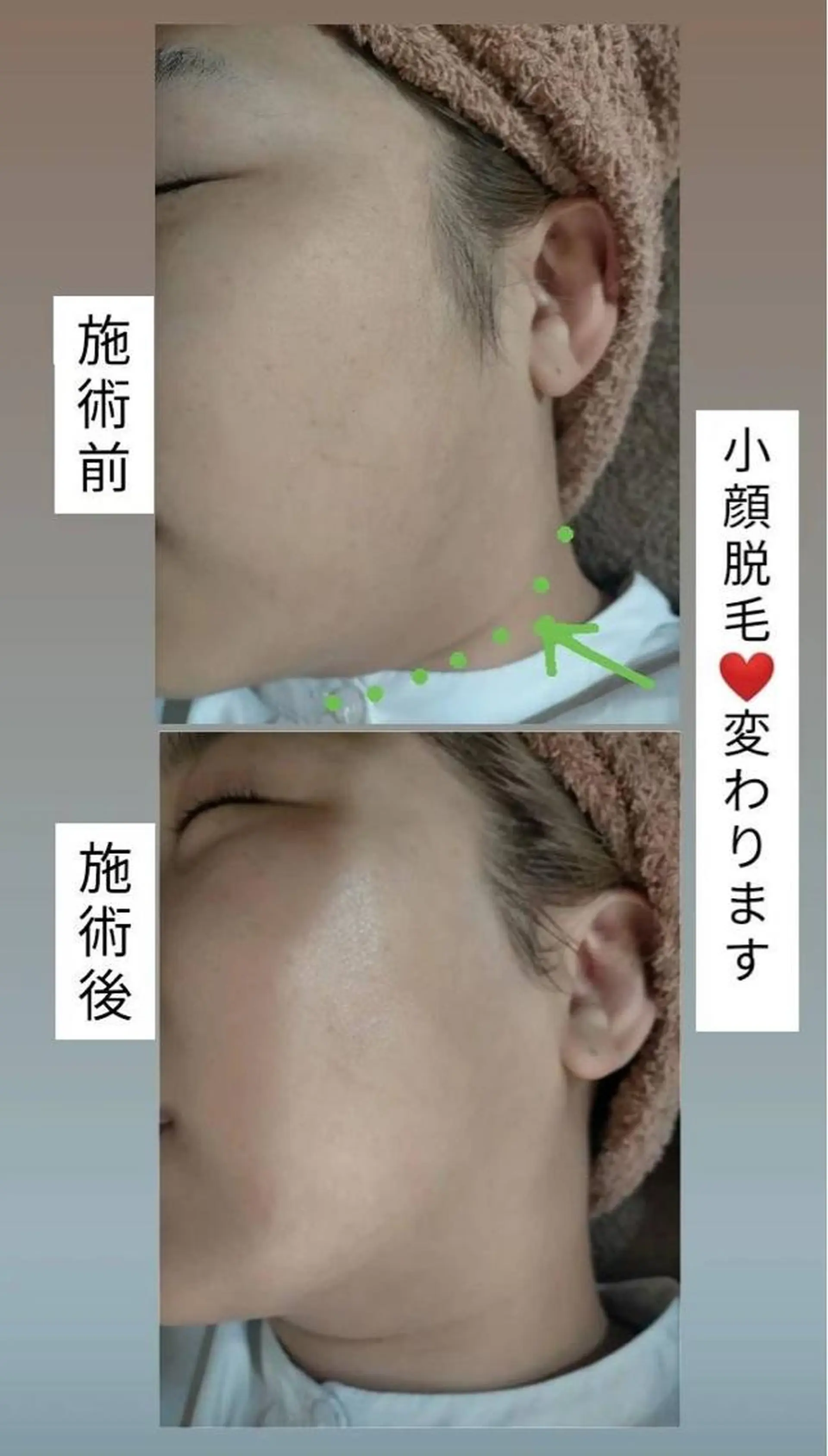 km retreat mentのエステ・リラクイメージ