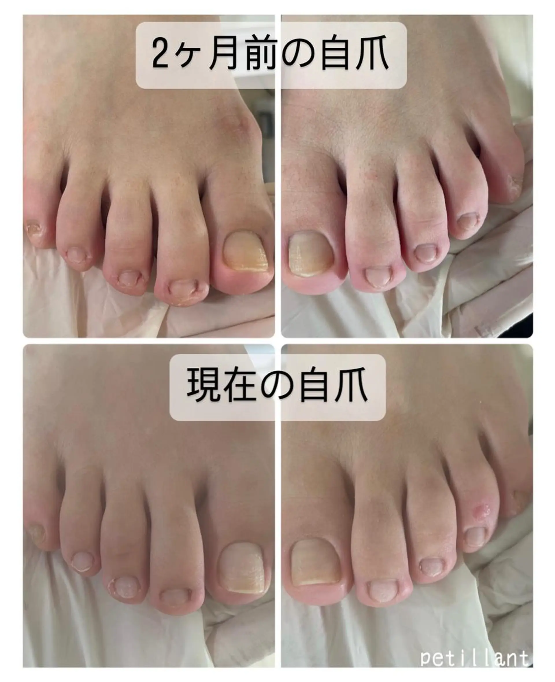 ネイル 長さ出し nail salon petillantのネイルデザイン