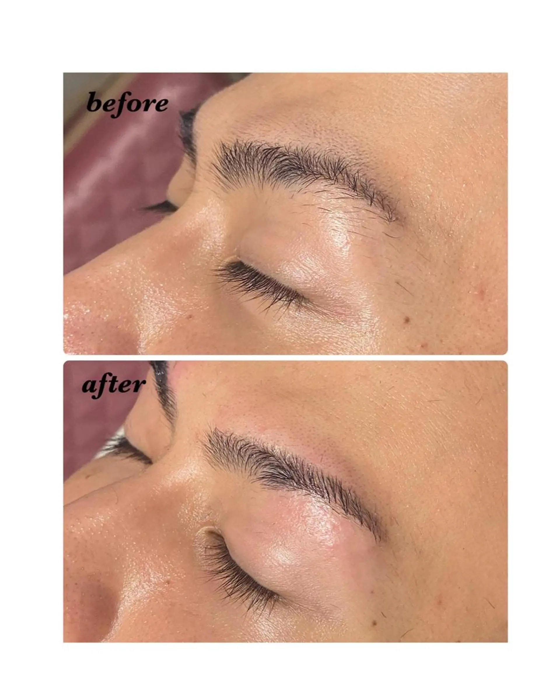 アイブロウ ハーブピーリング/韓国肌管理/フェイシャル/毛穴洗浄/眉毛/顔脱毛【糸脱毛専門】rev所属・ハーブピーリング専門 毛穴洗浄❤️眉waxのエステ・リラクイメージ