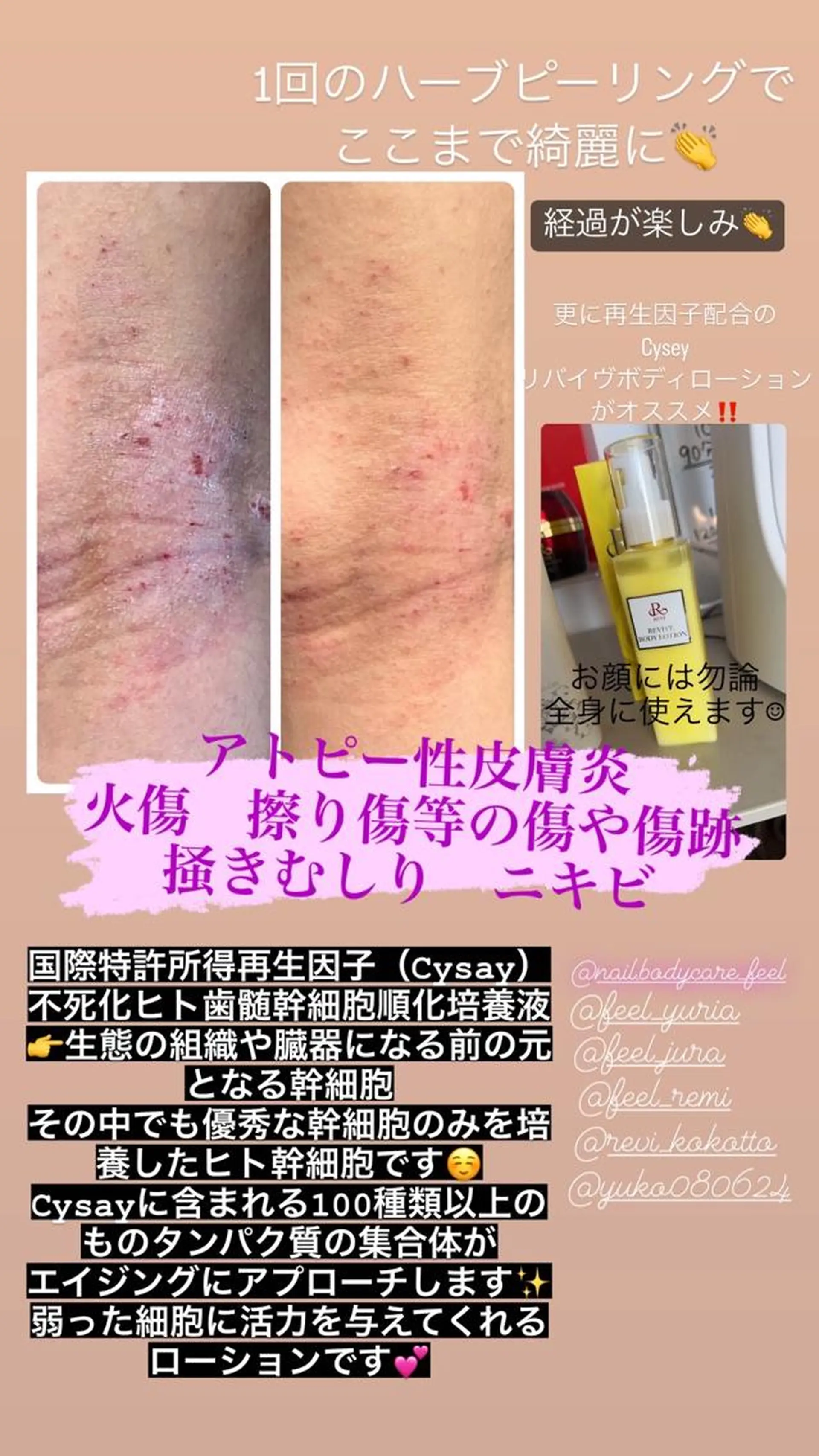 エステ Feel♡ JYURIAのネイルデザイン