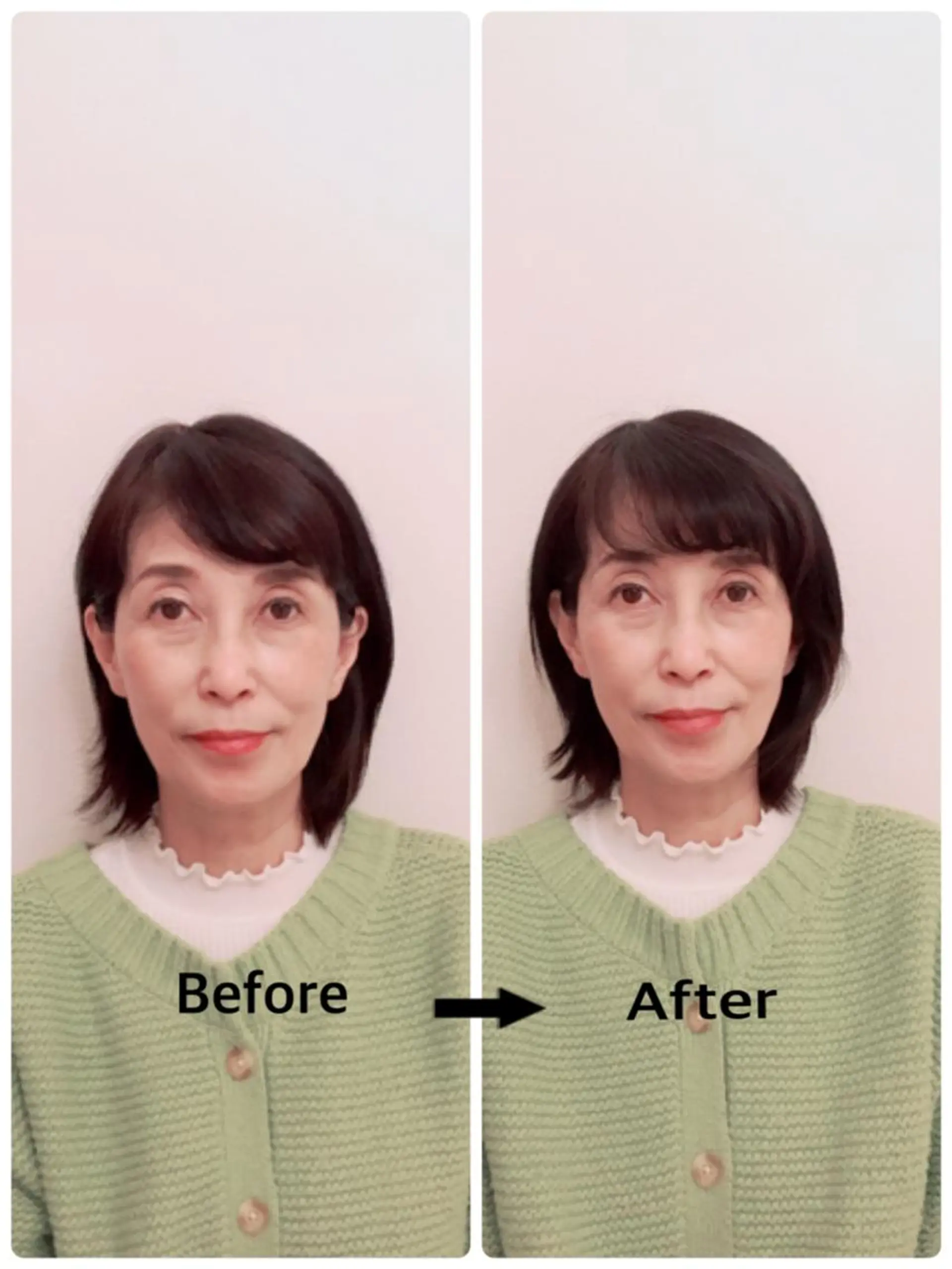 町田・鶴川 小顔矯正 /鈴木友実のエステ・リラクイメージ