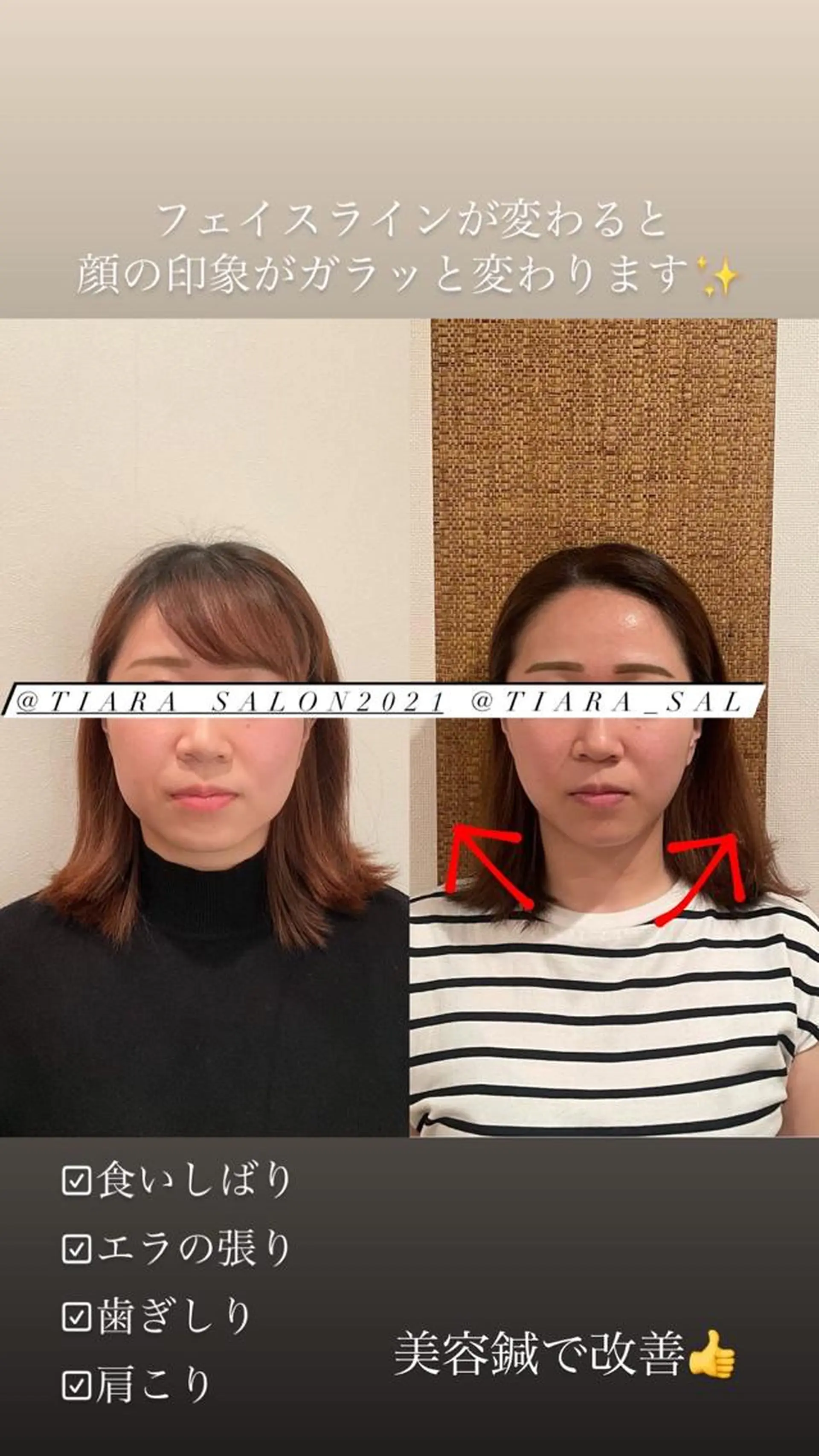 セミロング カラー パーマ ヘアアレンジ メンズ キッズ ネイル マツエク・マツパ アイブロウ 美容鍼灸サロン　TIARA所属・鍼灸サロン TIARA　美容鍼のエステ・リラクイメージ