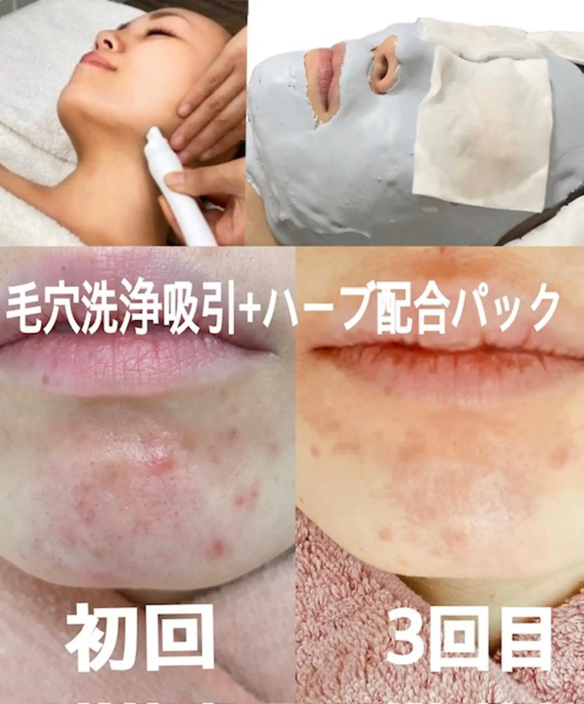 肌ケア＆毛穴洗浄 Cheri/女性専用のエステ・リラクイメージ