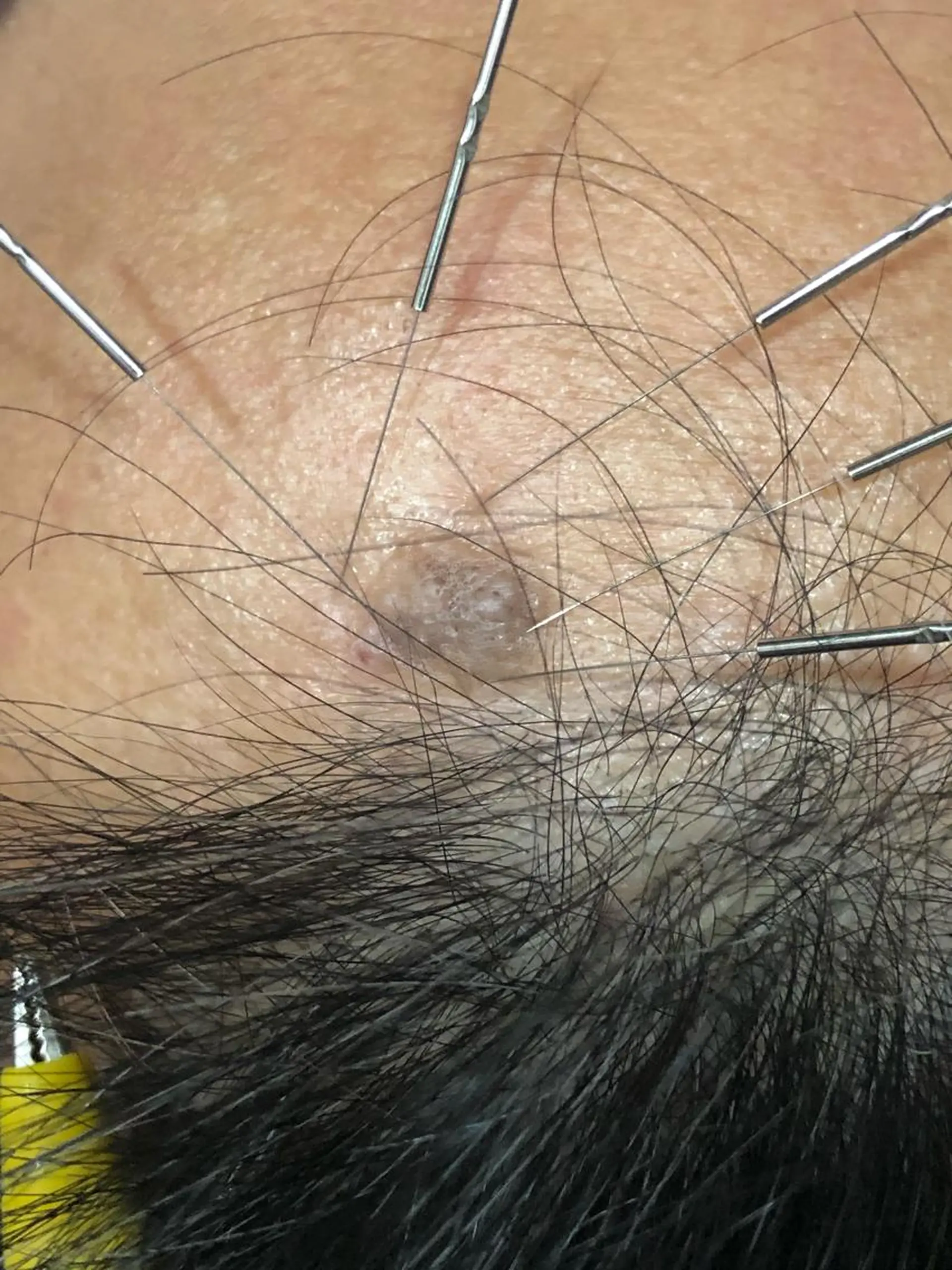 セントラル鍼灸院 Re:laxyのヘアスタイル