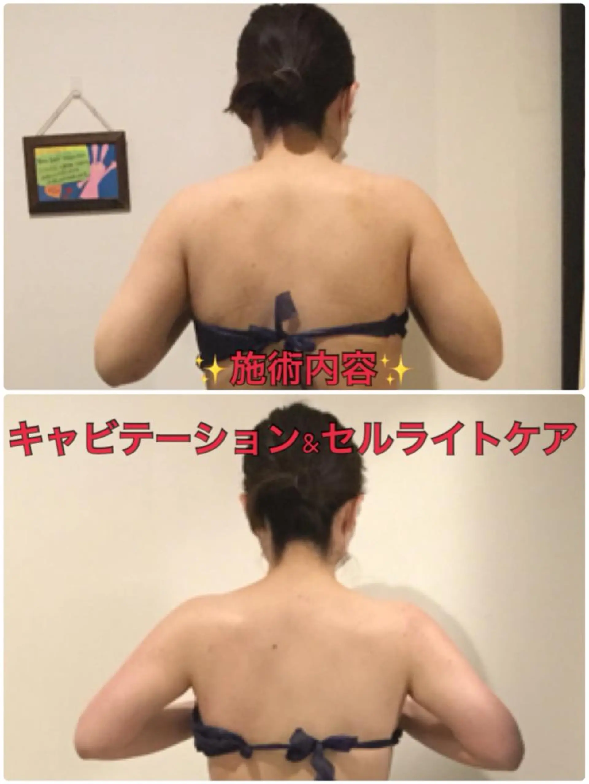 ラヴィ二ティ 大宮店のエステ・リラクイメージ