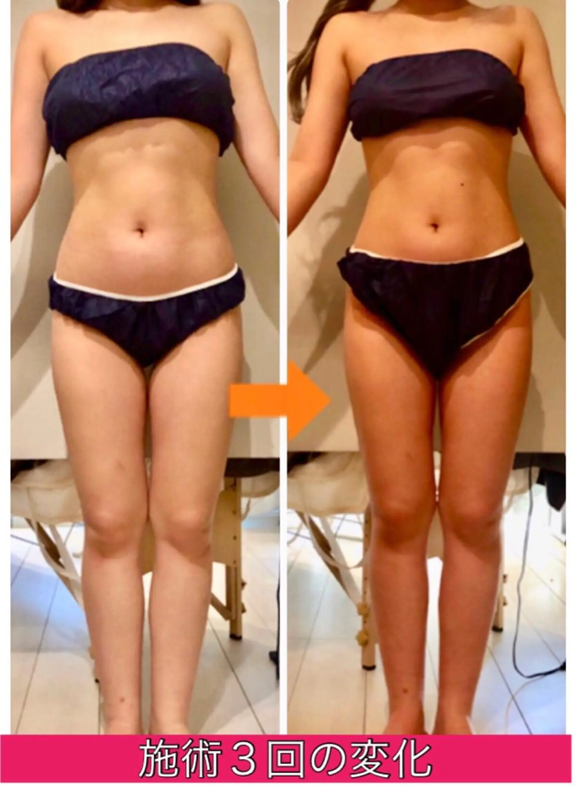 ロング カラー パーマ ヘアアレンジ メンズ キッズ ネイル マツエク・マツパ マットネイル ‍痩身＆ボディ 結果出し🌟丹野のエステ・リラクイメージ