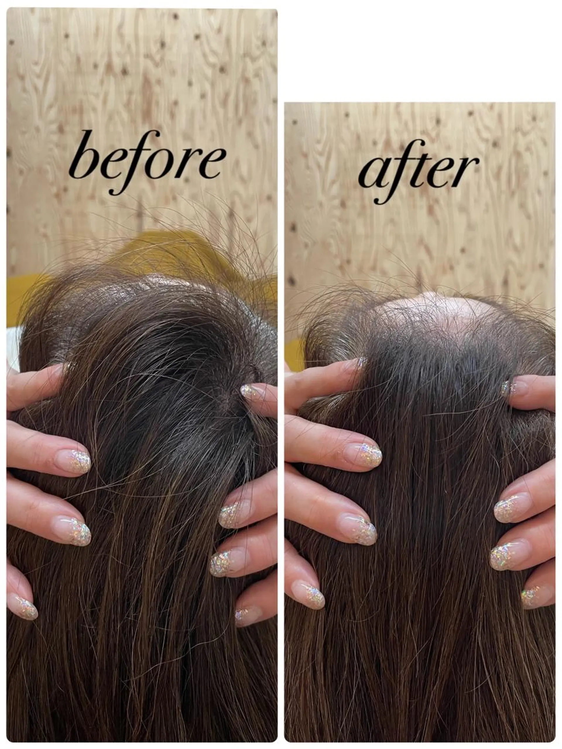 リラク 個室ドライヘッドスパ 🍃moriのエステ・リラクイメージ