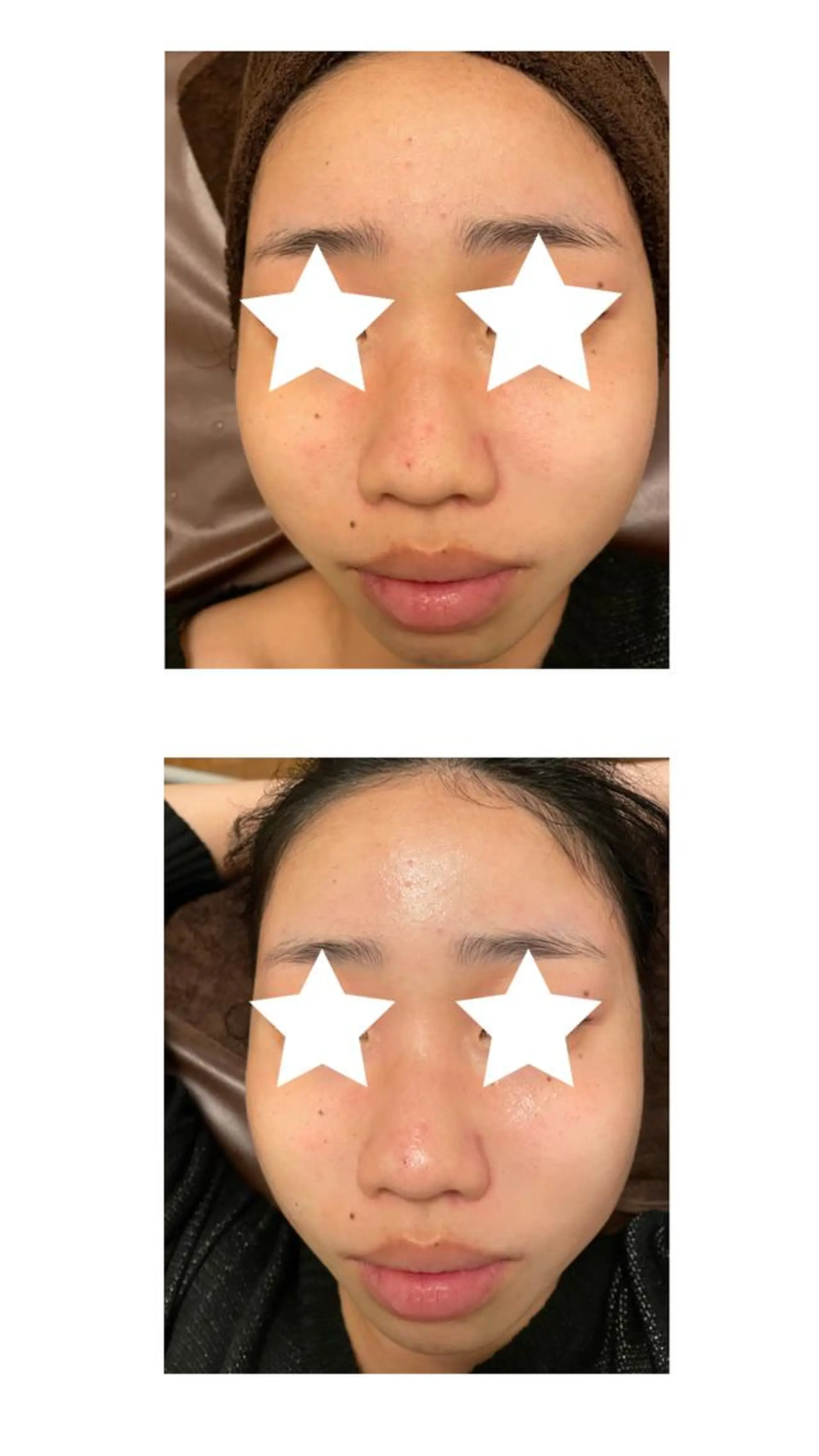 エステ 体質別痩身&小顔 MA CHÉRIEのエステ・リラクイメージ