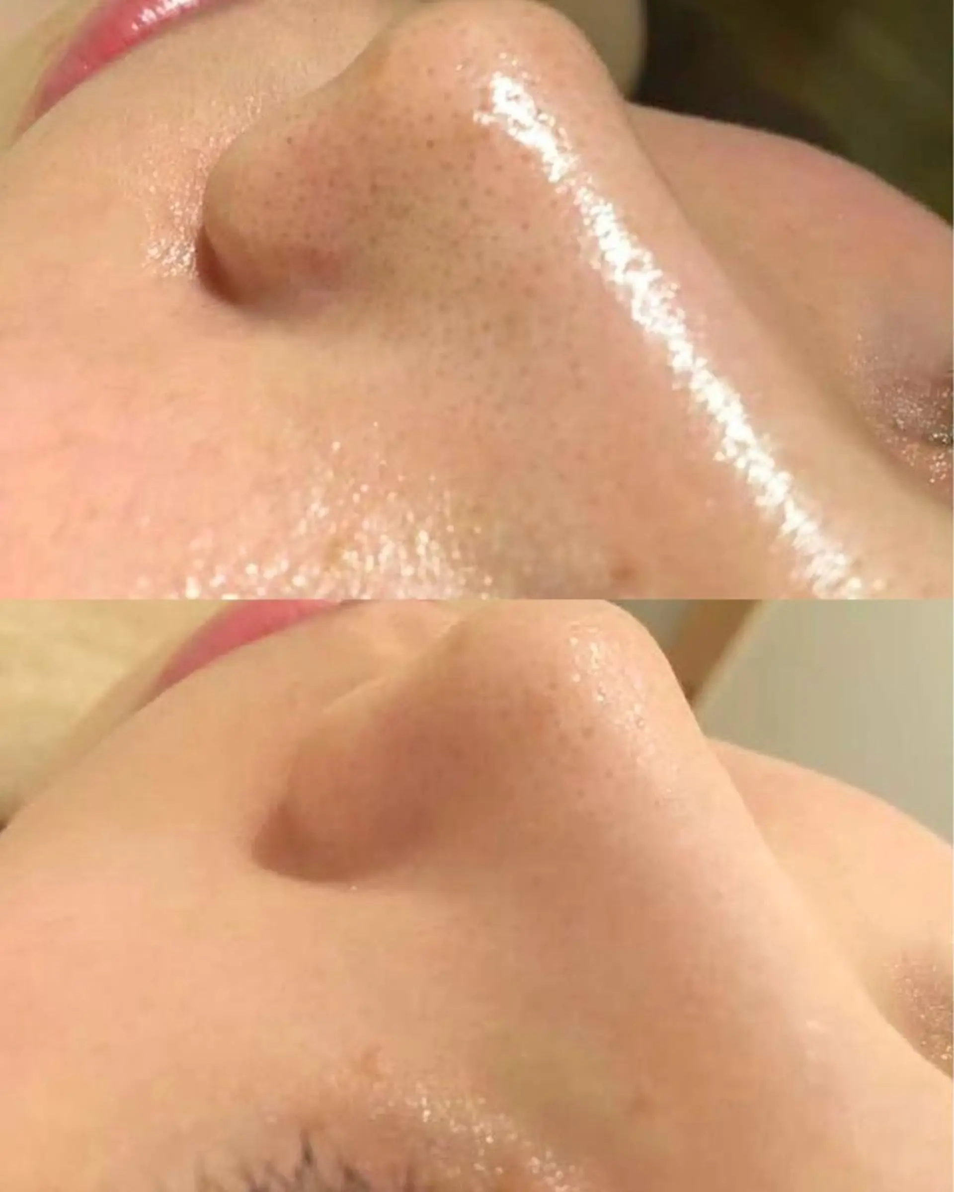 エステ リラク ニキビ・肌質改善専門 ♡人生が変わるサロンのエステ・リラクイメージ