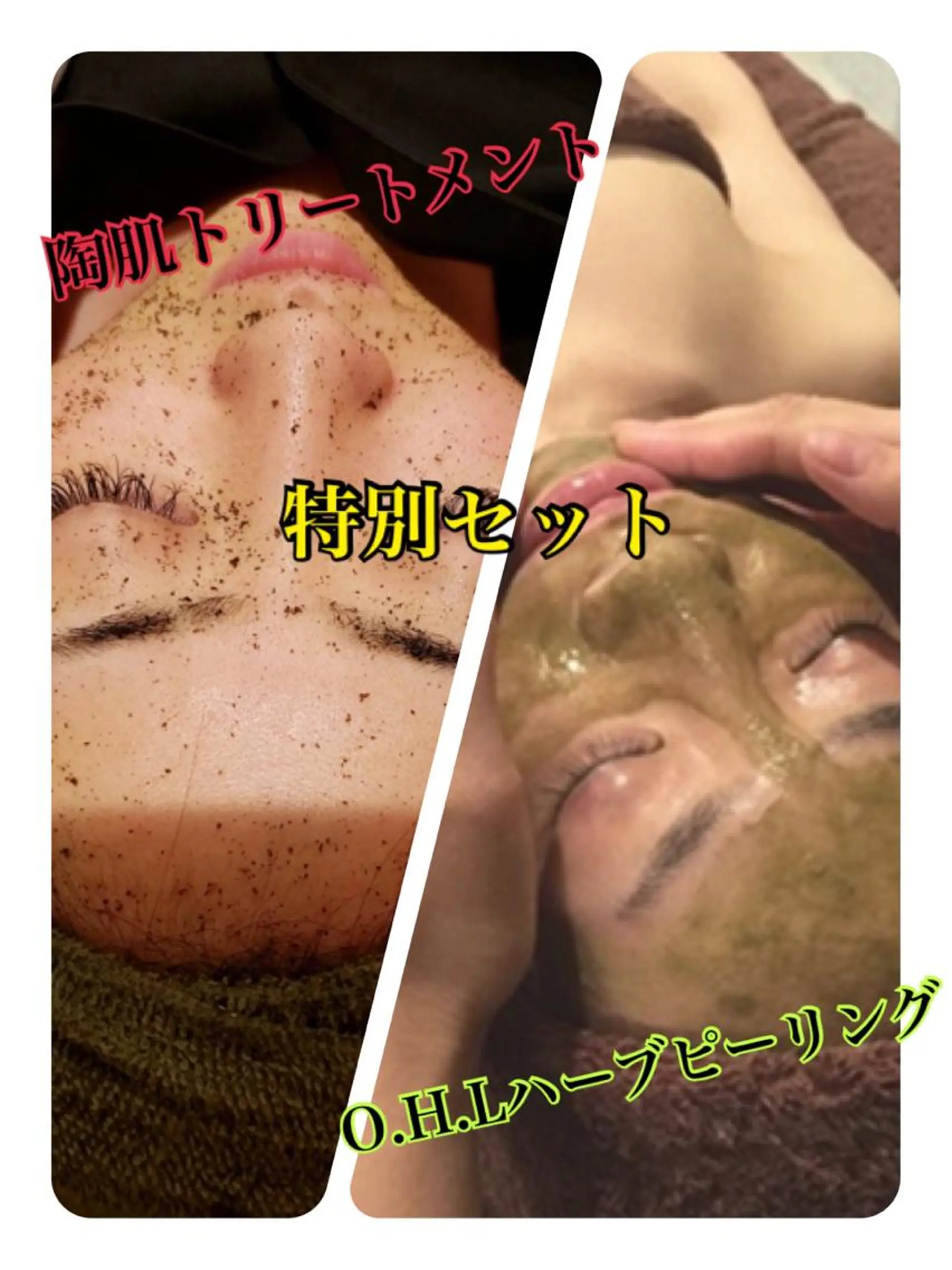 エステ 【リベルハーブピーリング認定店】敏感肌・美白脱毛専門店Dione立川店所属・Dione 立川店のエステ・リラクイメージ