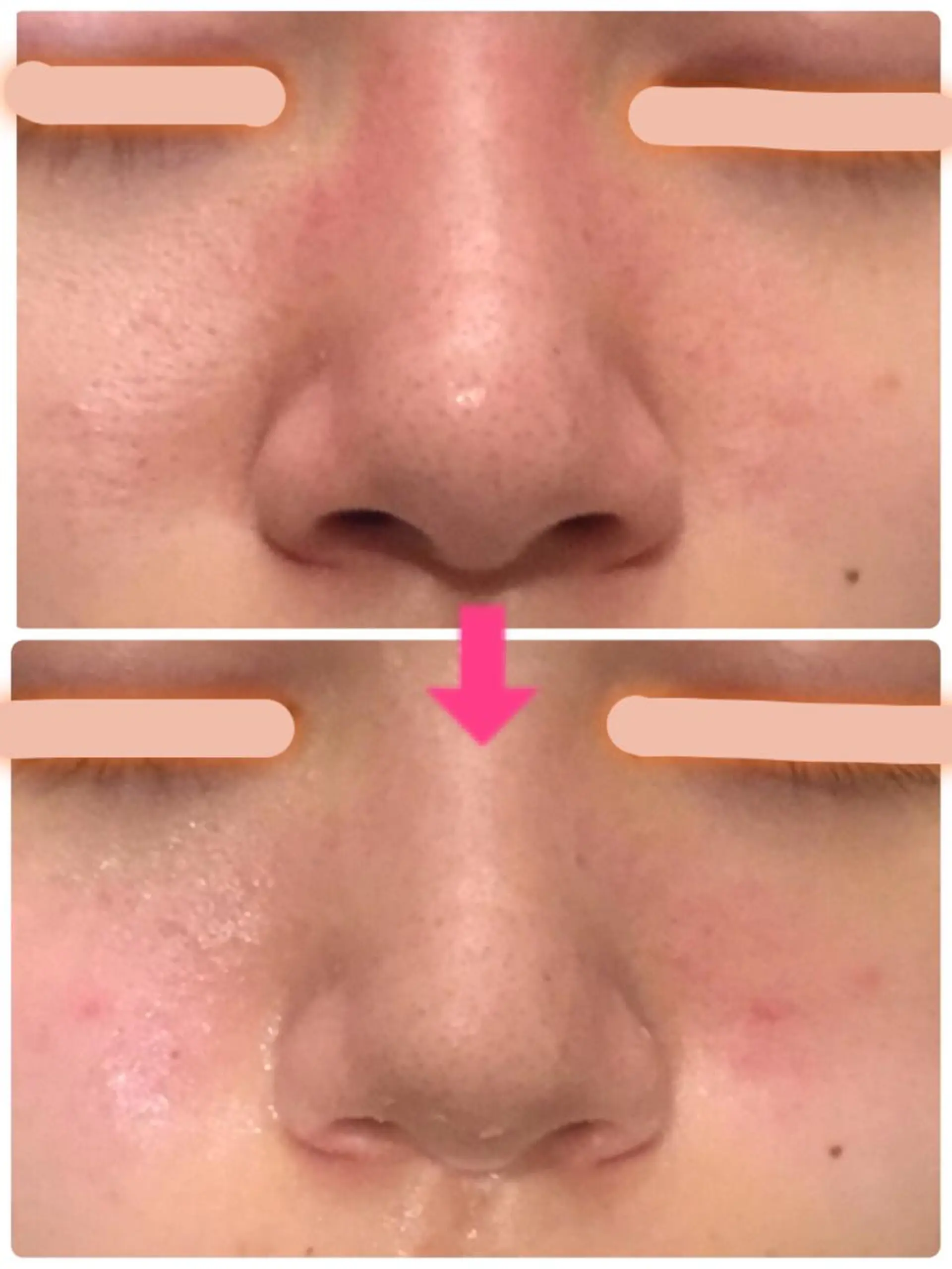 ロング カラー パーマ ヘアアレンジ メンズ キッズ ネイル マツエク・マツパ 赤色 ‍痩身＆ボディ 結果出し🌟丹野のエステ・リラクイメージ