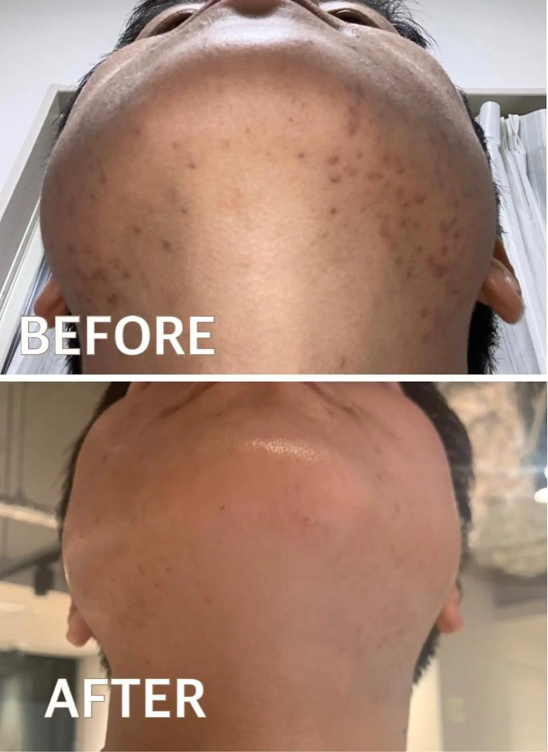 メンズ 大阪脱毛|ちぇるま| 眉毛Wax|美肌管理のエステ・リラクイメージ