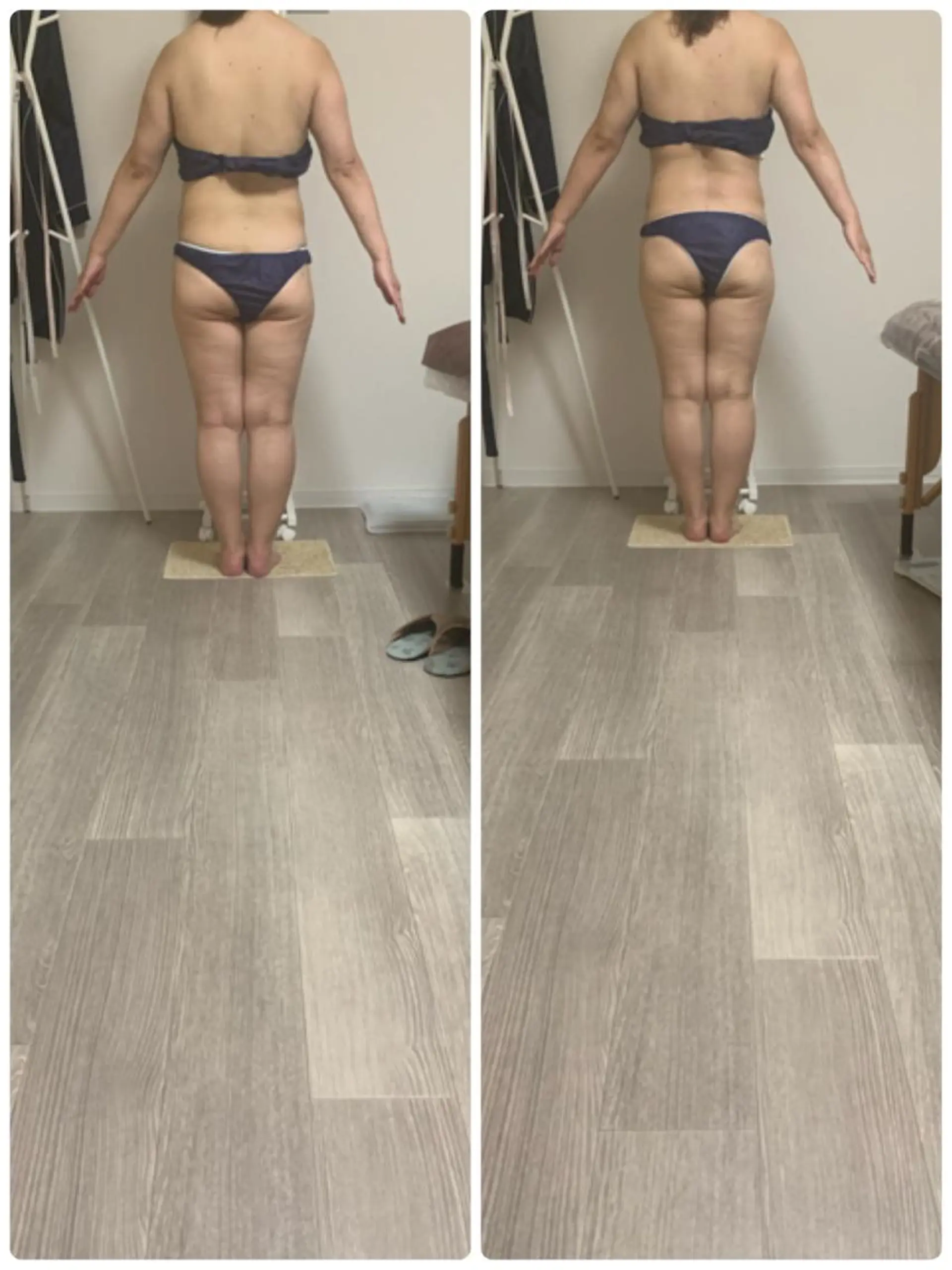 美ボディメイクサロン　only one body所属・所沢 痩身エステサロンのエステ・リラクイメージ