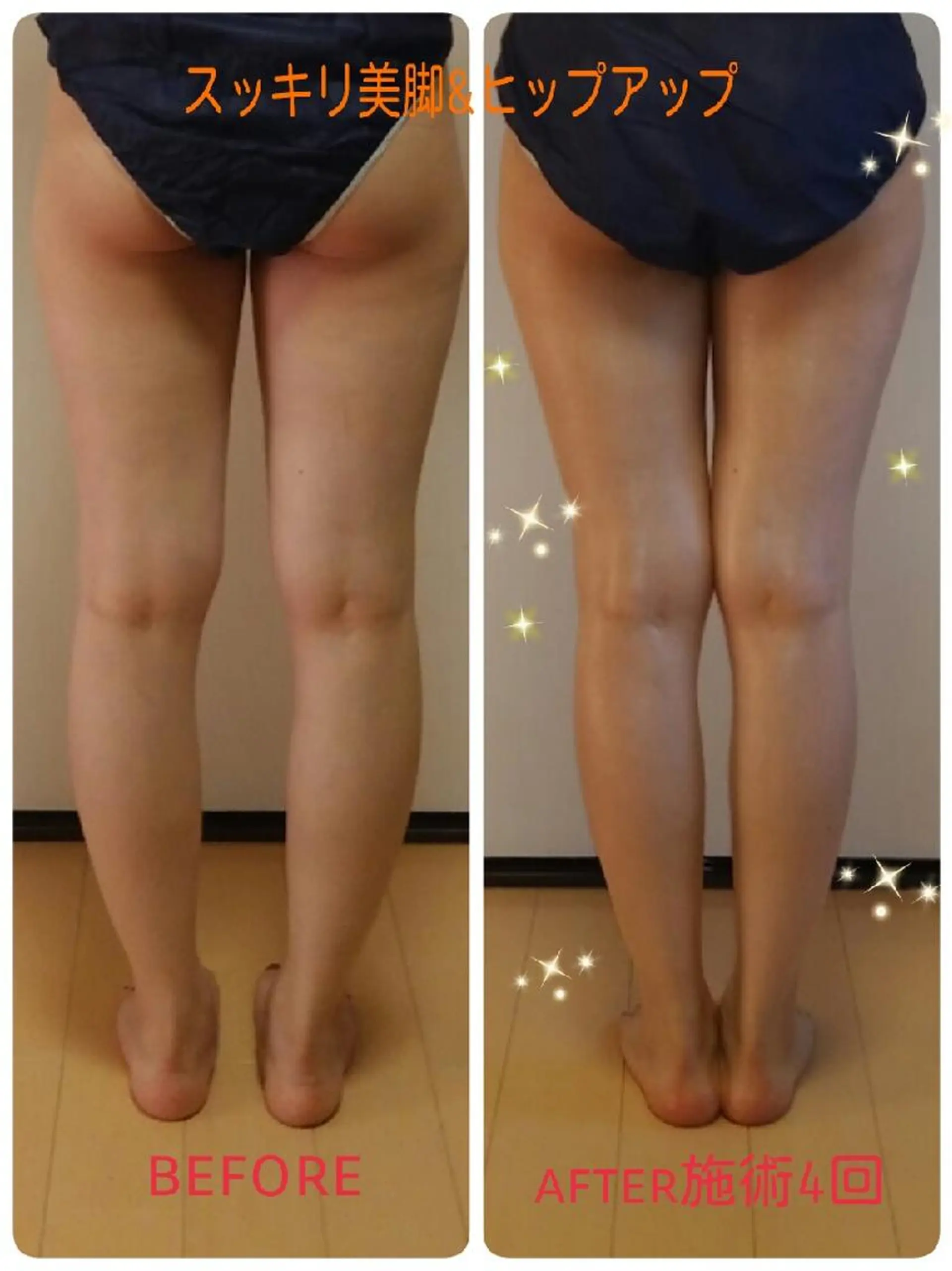 リンパサロン レディ ワンのエステ・リラクイメージ