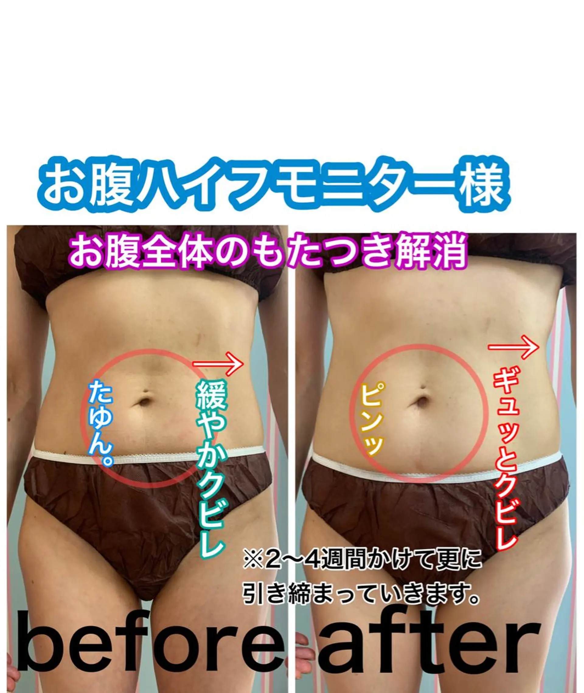 痩身/脱毛/ネイル HARUKAのエステ・リラクイメージ