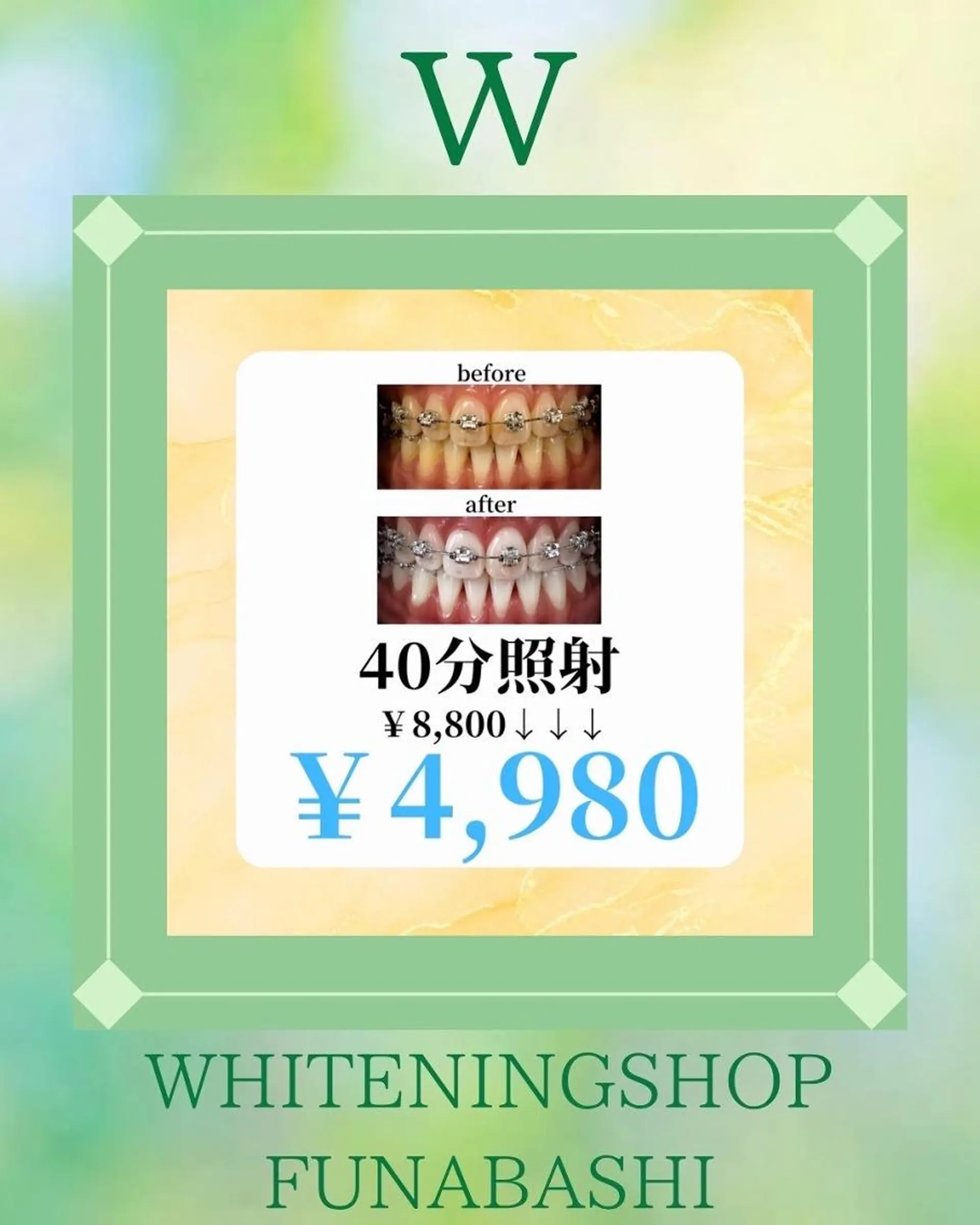 ホワイトニング ショップ船橋店🦷のエステ・リラクイメージ