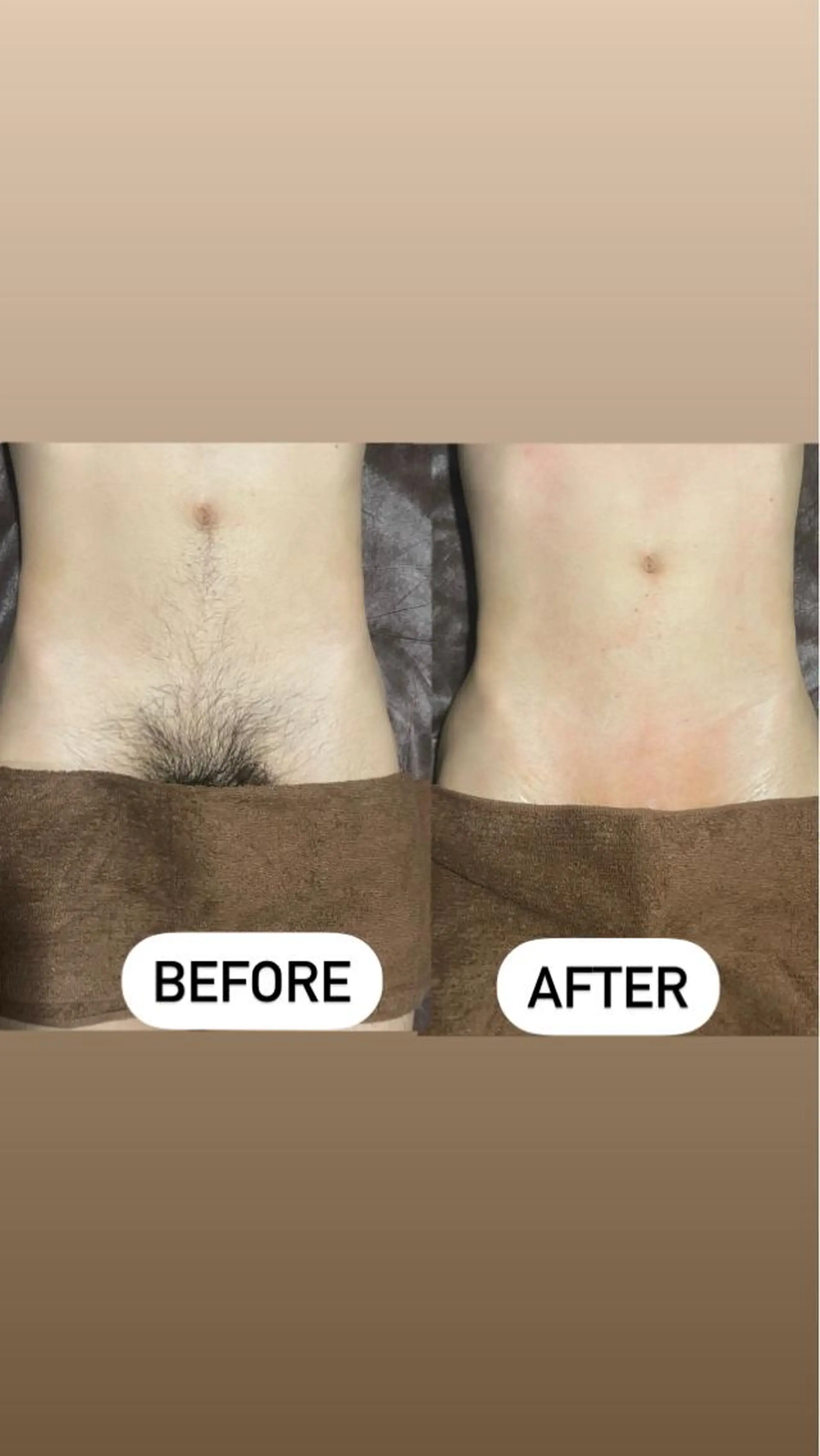 メンズ 脱毛 メンズ眉毛ITSUK Iメンズ専門　新宿の眉毛・アイブロウイメージ