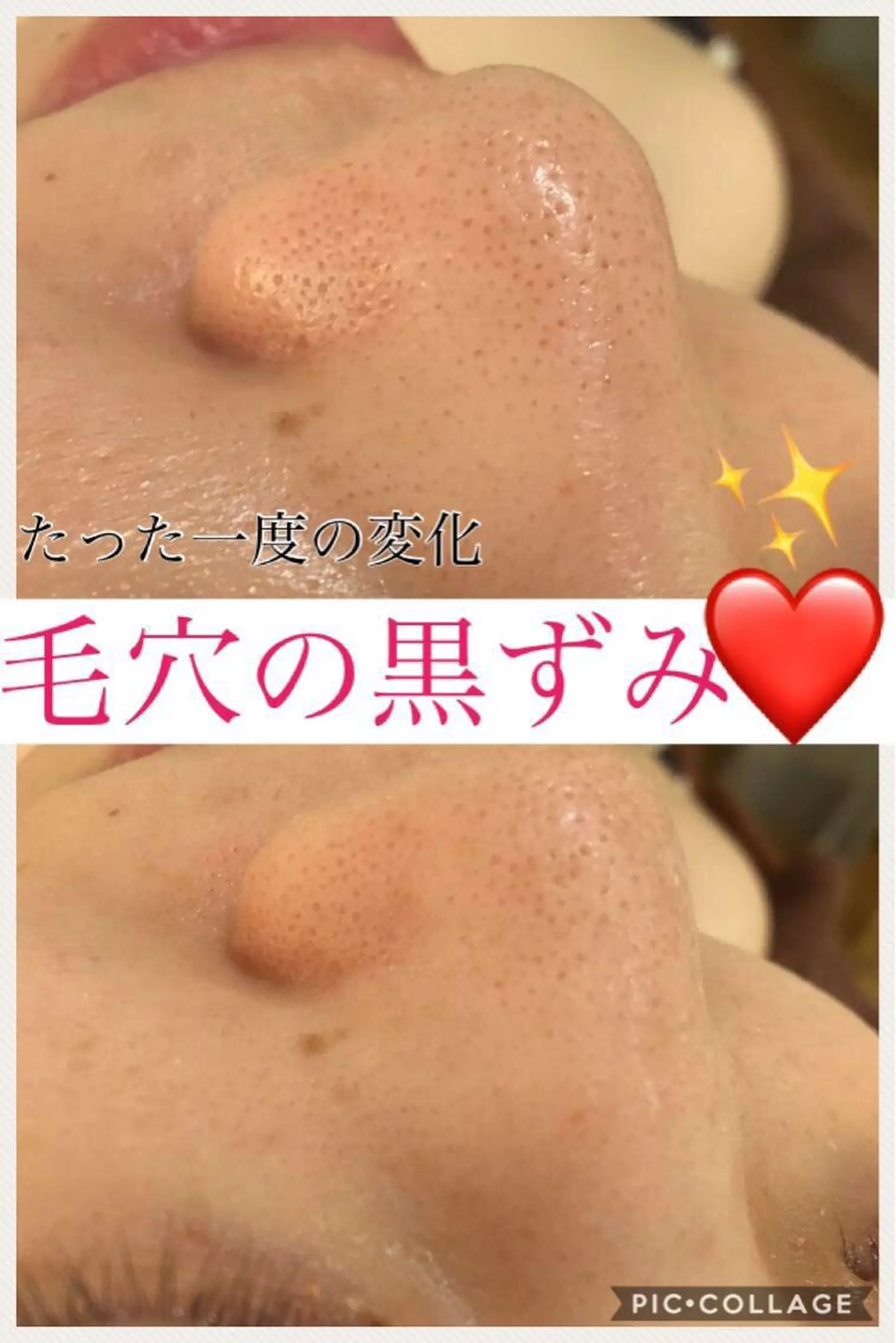 ミディアム カラー パーマ ヘアアレンジ メンズ キッズ ネイル マツエク・マツパ ニキビ・肌質改善専門 ♡人生が変わるサロンのエステ・リラクイメージ