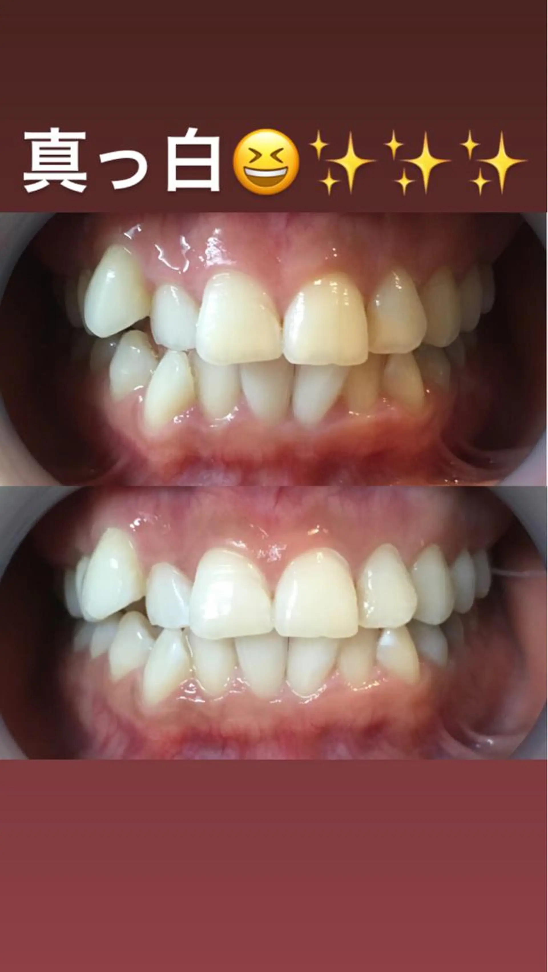 LBSホワイトニング 新宿店💎店長のエステ・リラクイメージ