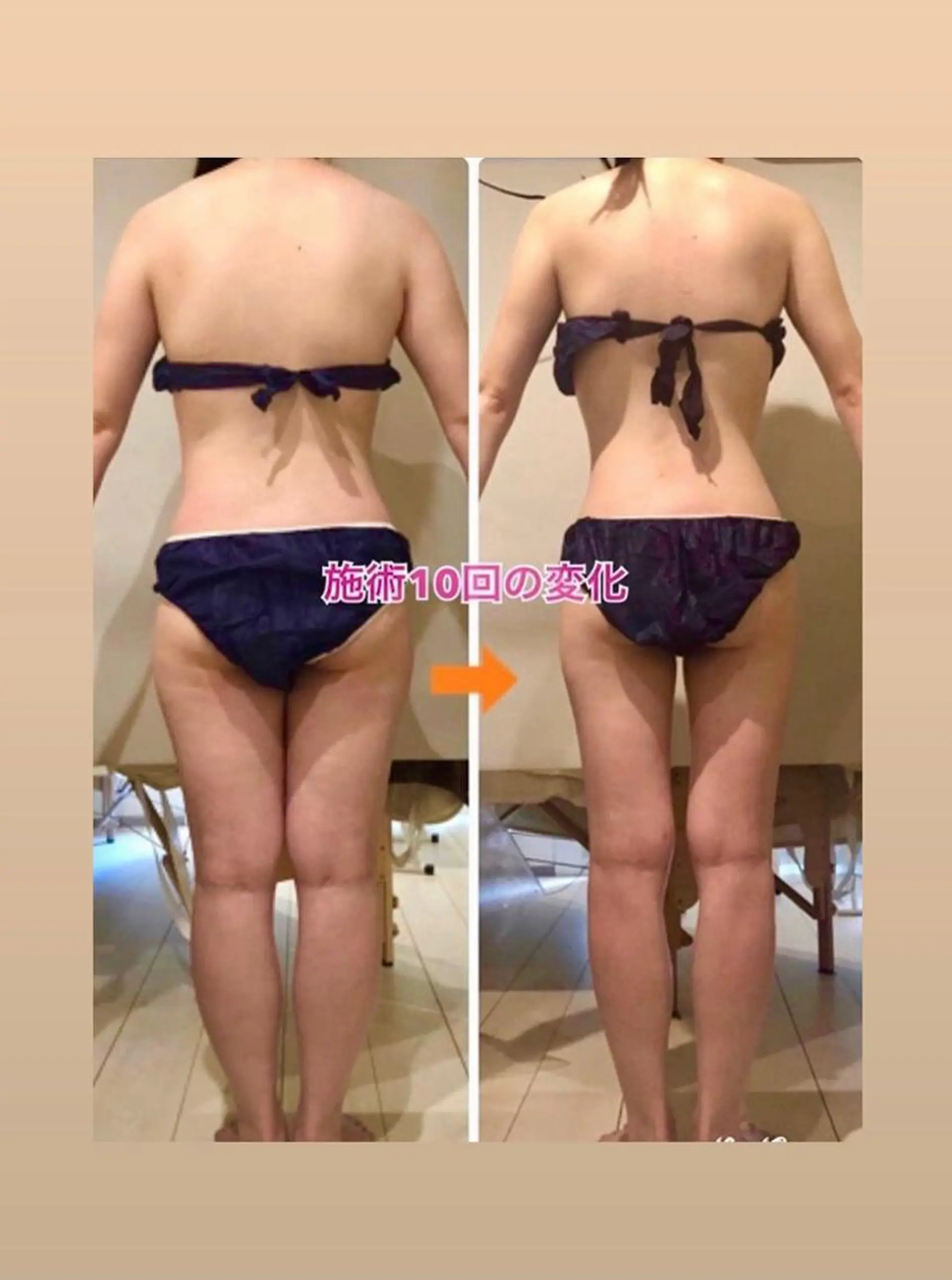 ショート カラー パーマ ヘアアレンジ メンズ キッズ ネイル マツエク・マツパ ‍痩身＆ボディ 結果出し🌟丹野のエステ・リラクイメージ