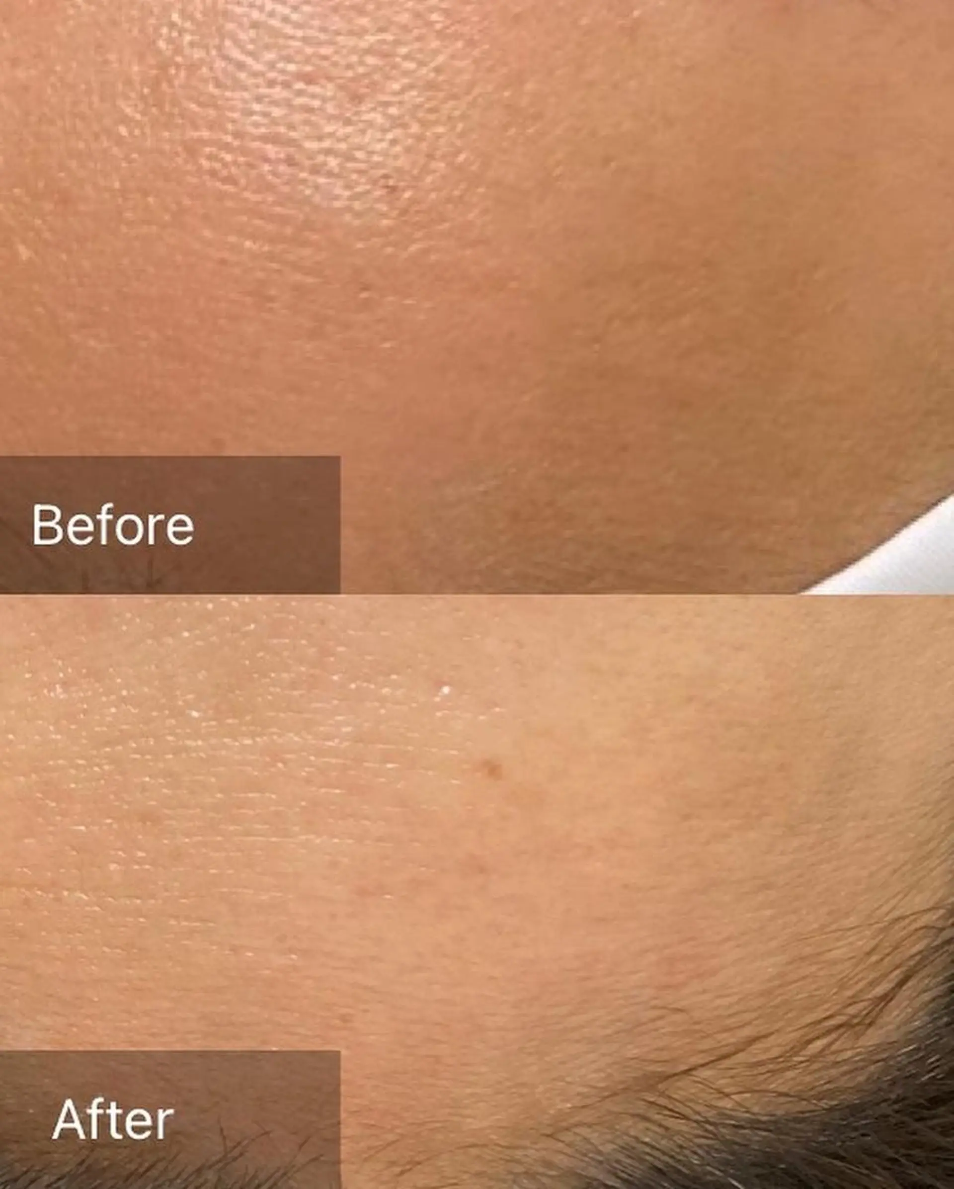 脱毛 産毛専門店 Bittoのエステ・リラクイメージ