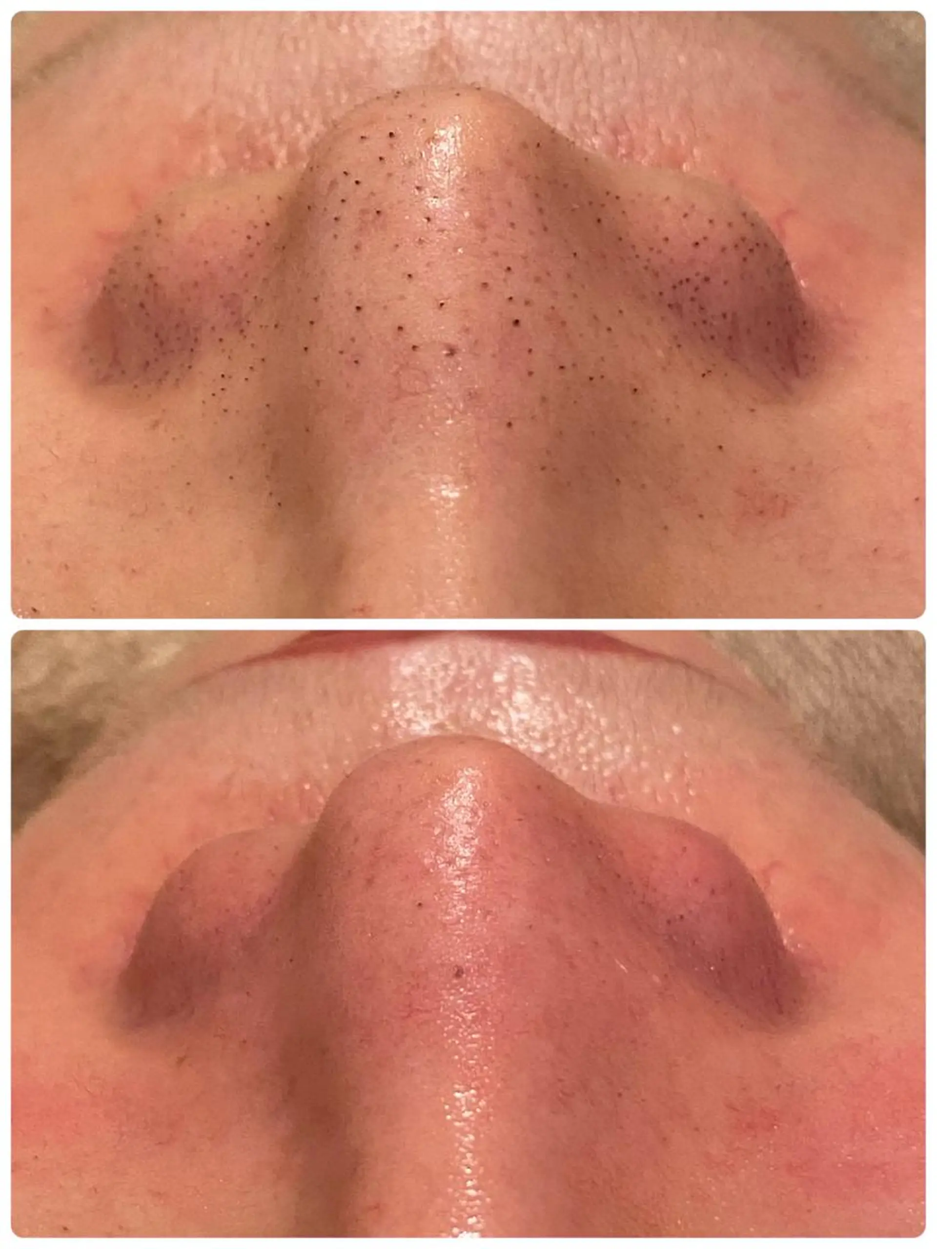 【リベルハーブピーリング認定店】敏感肌・美白脱毛専門店Dione立川店所属・Dione 立川店のエステ・リラクイメージ