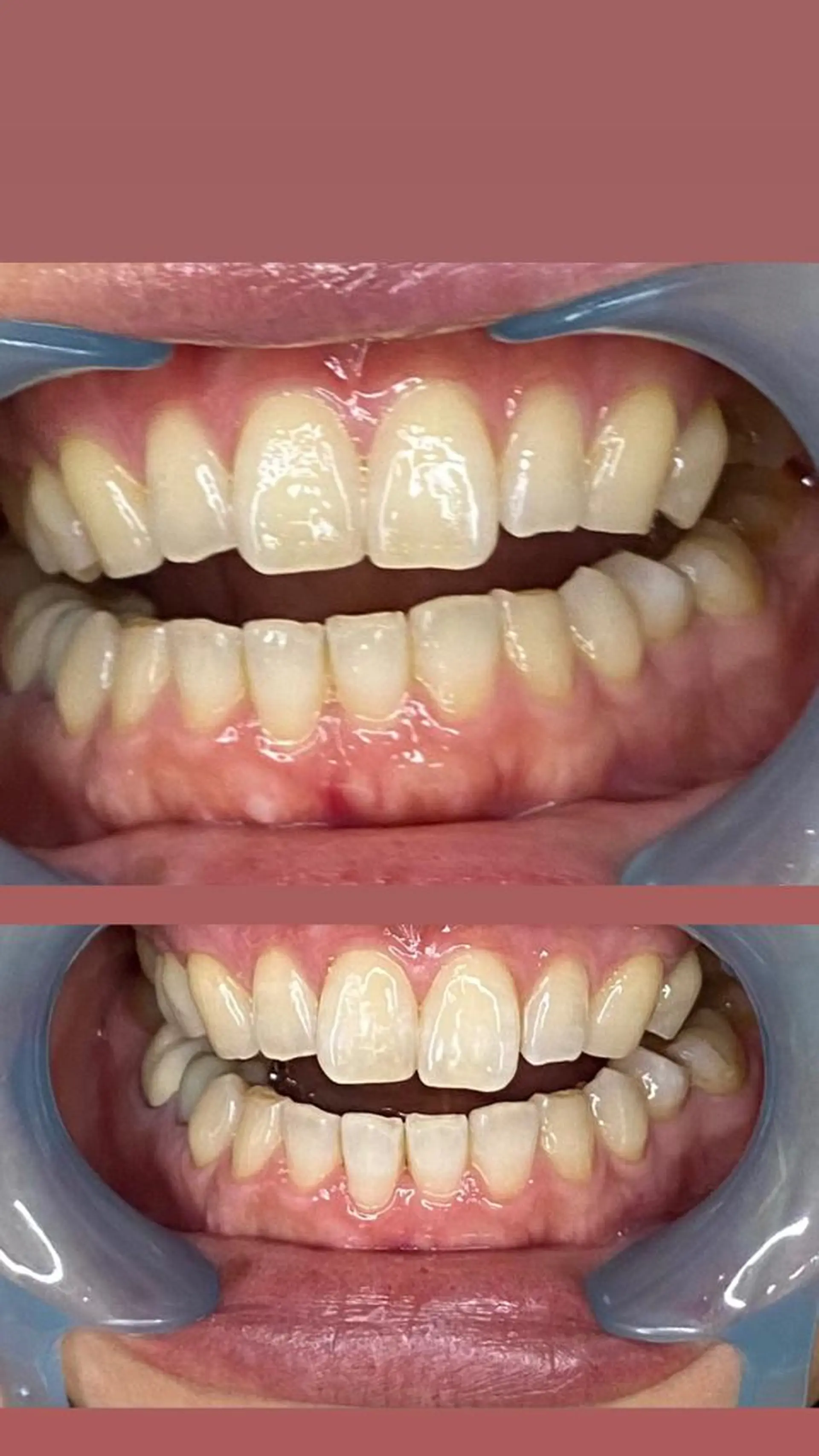 LAVISH nail salonのヘアスタイル