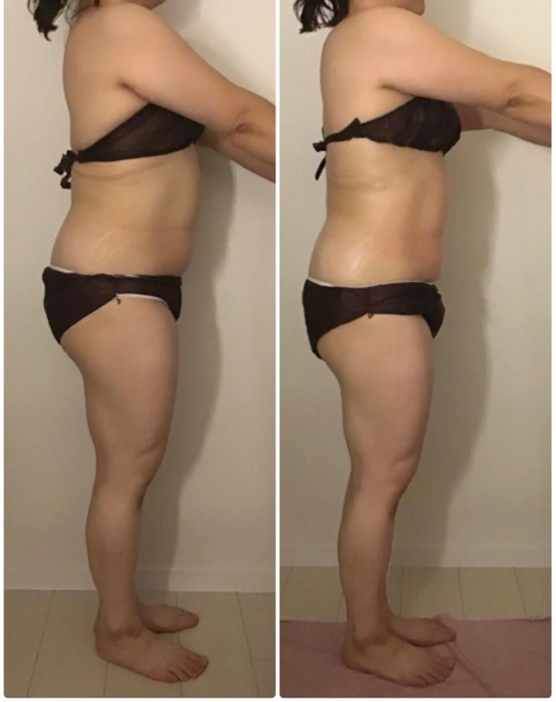 エステ リラク BELLEFINE 💕痩身・小顔・脱毛のエステ・リラクイメージ