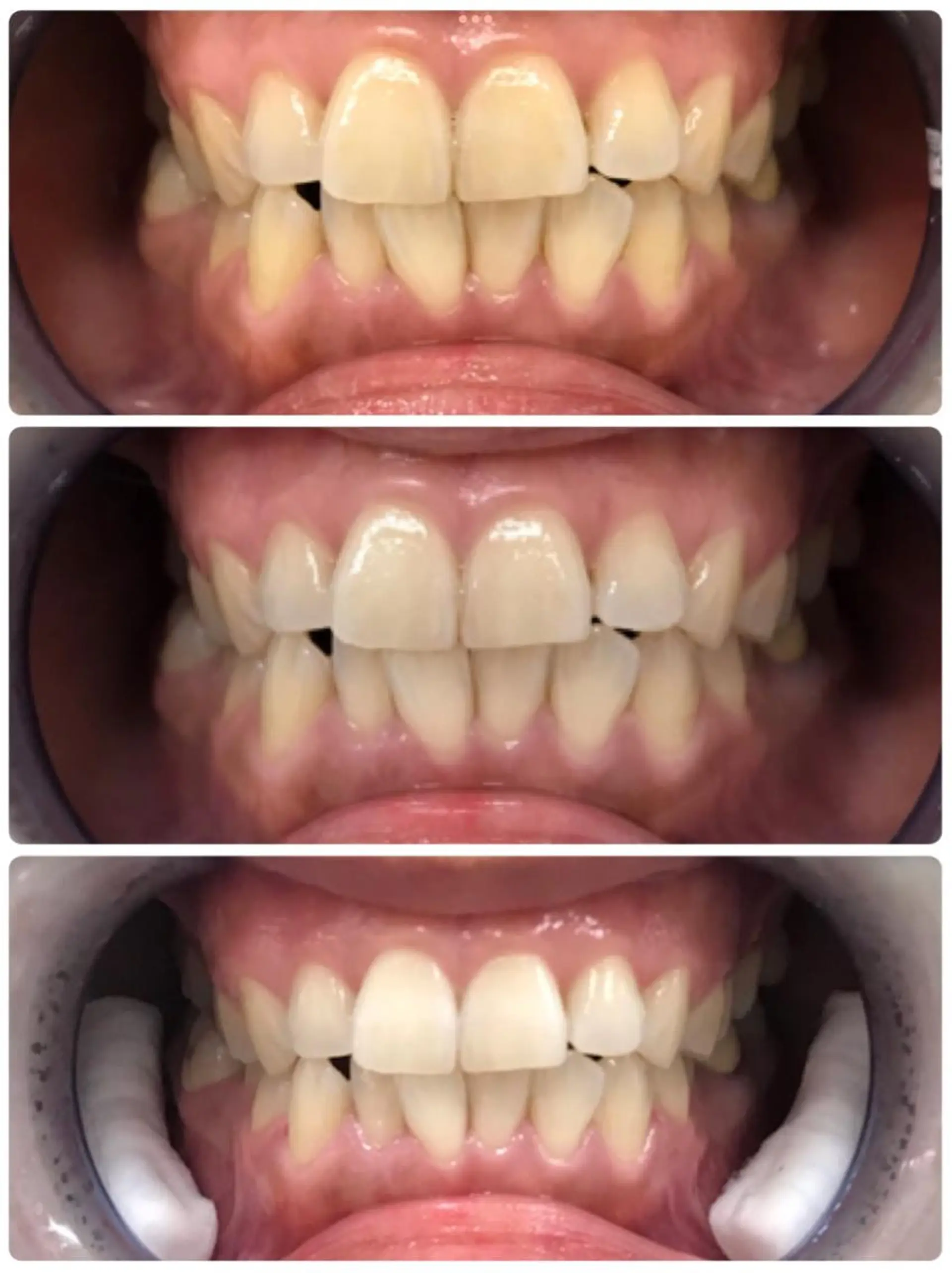 noel de mi 前川亜里沙のエステ・リラクイメージ