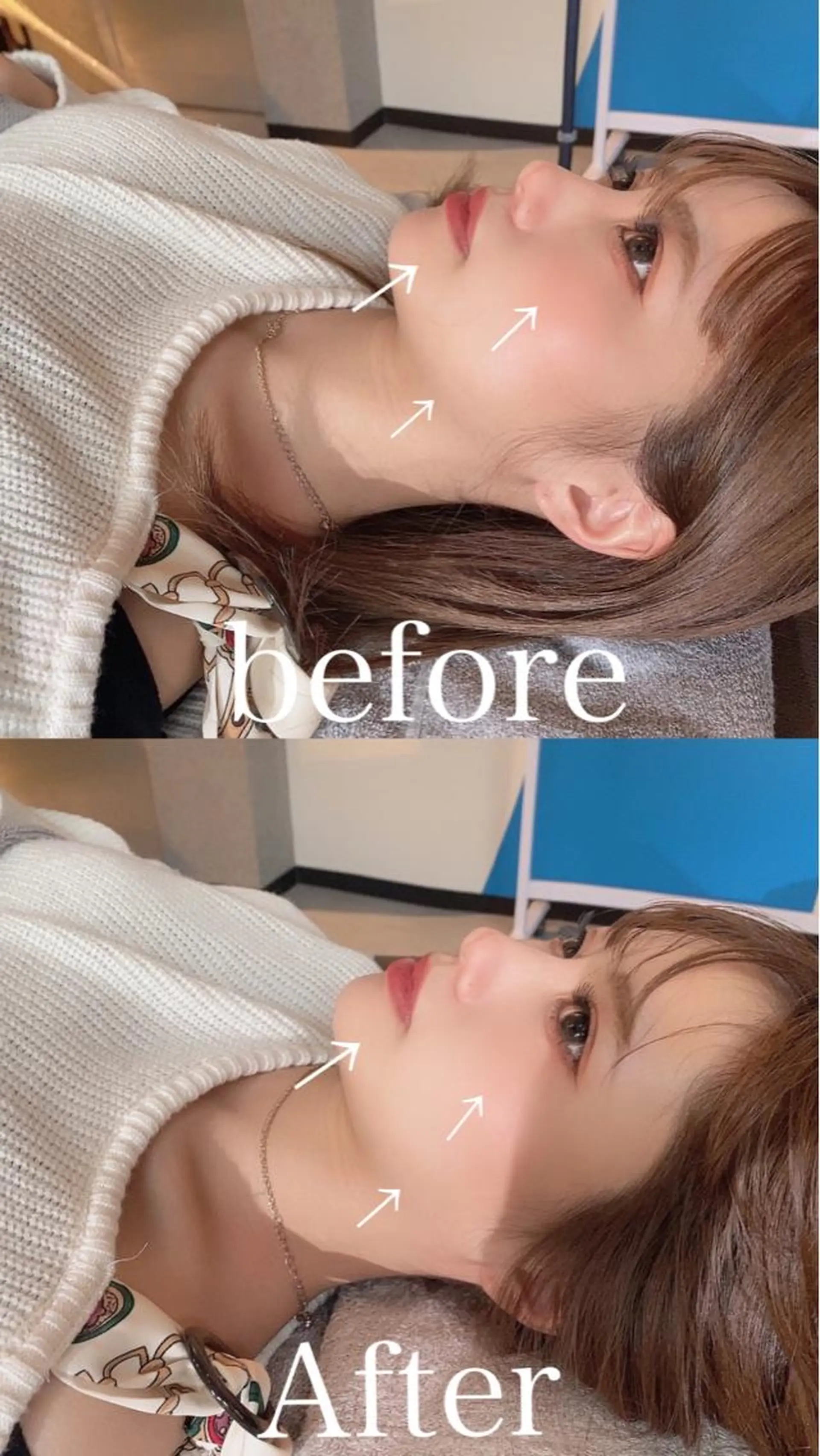 鍼灸整骨院Refine所属・鍼灸 Refineのその他イメージ