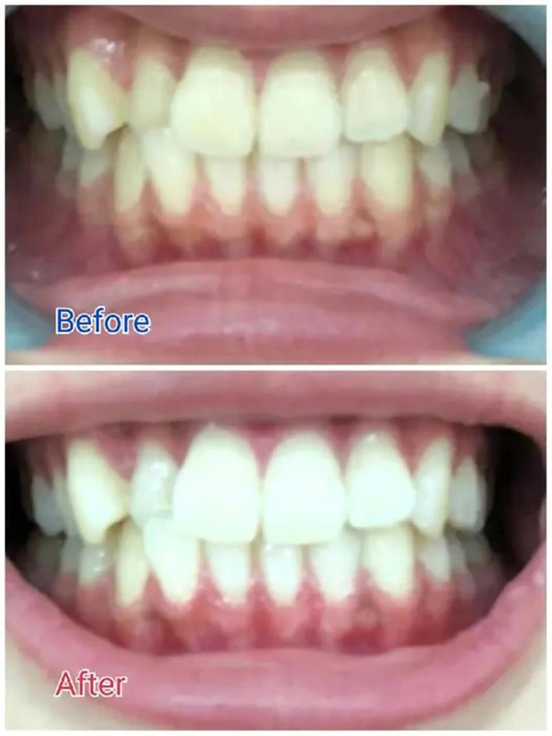 M渋谷 ホワイトニングのエステ・リラクイメージ