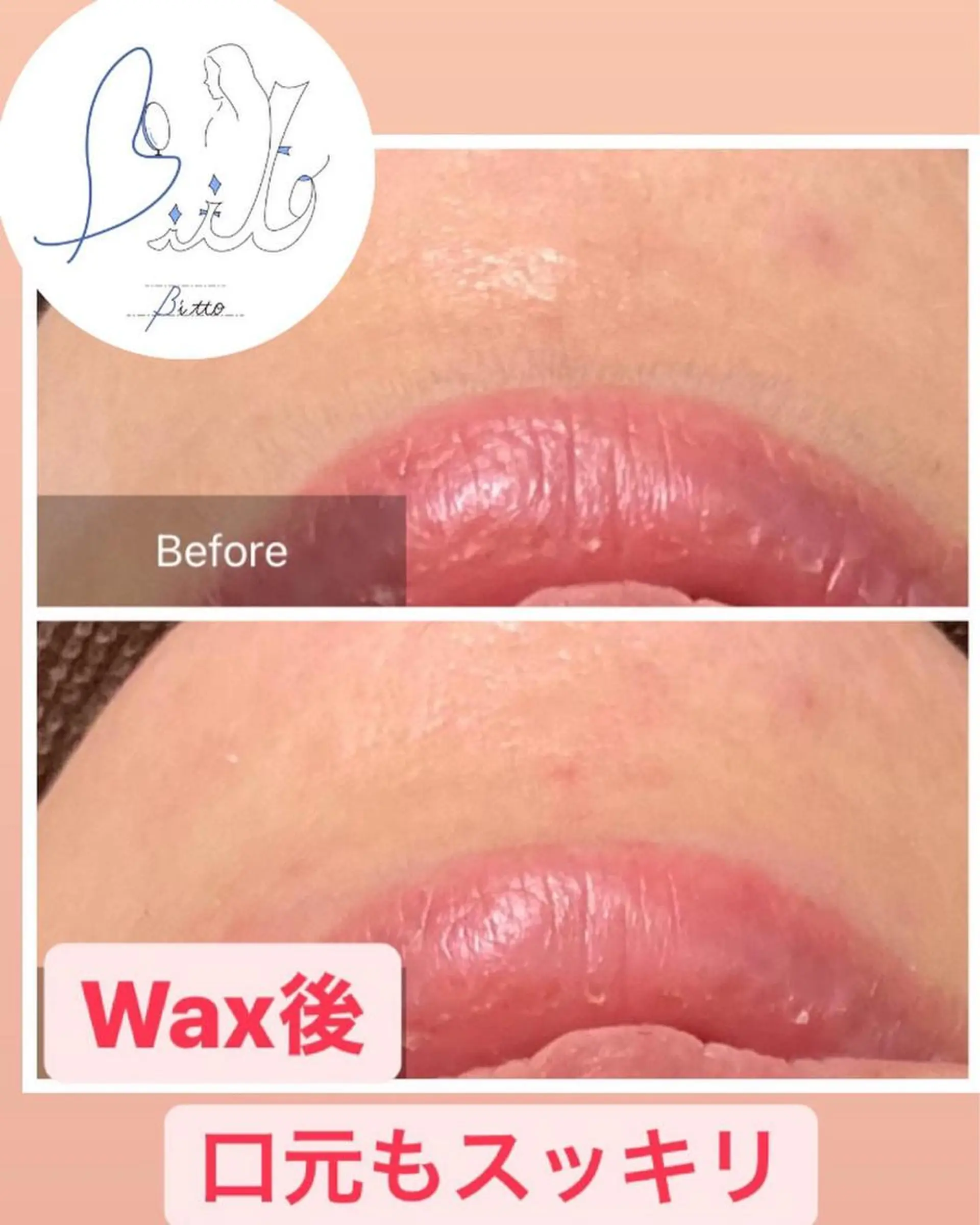 脱毛 産毛専門店 Bittoのエステ・リラクイメージ